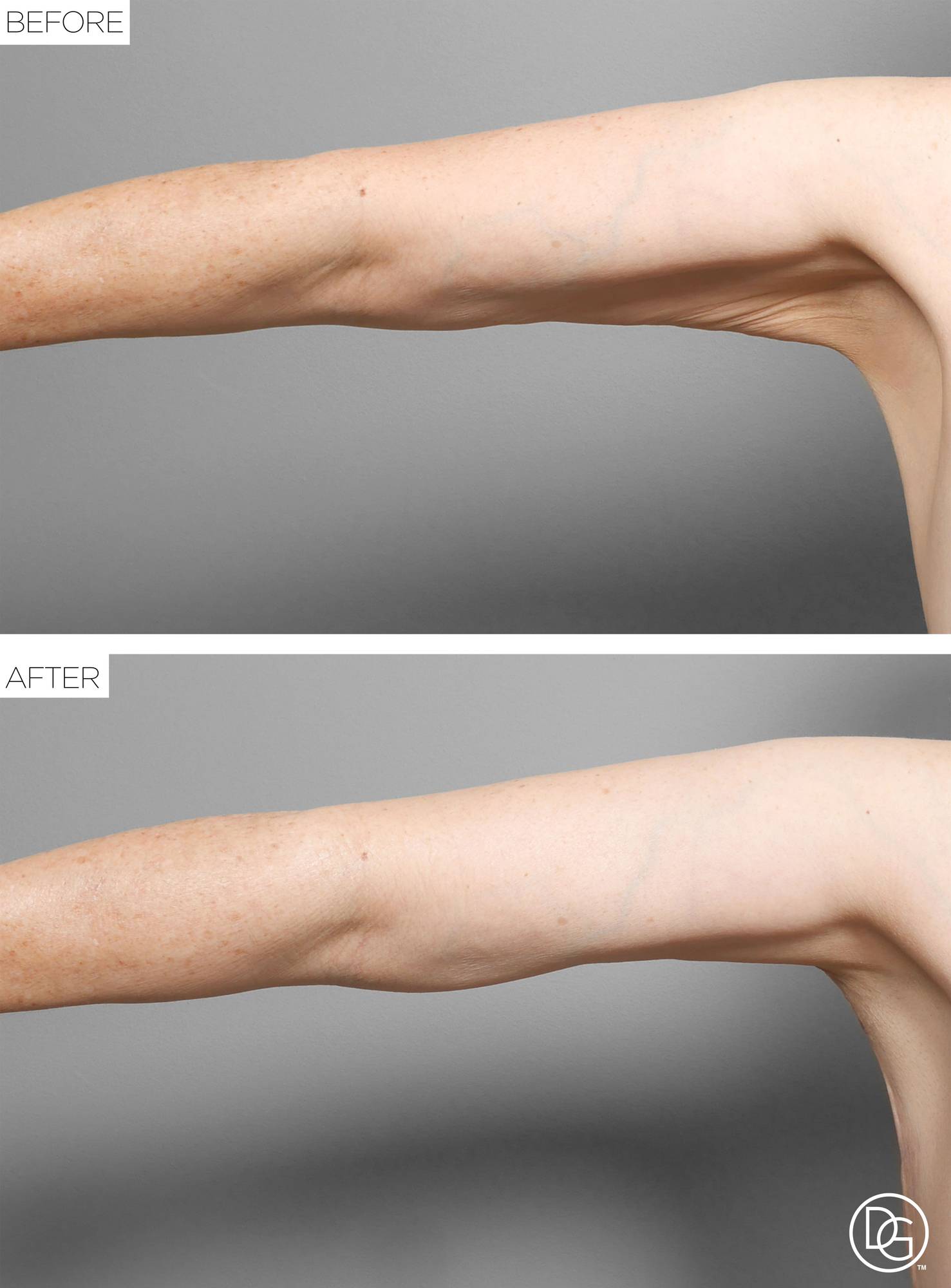 Before & After Image