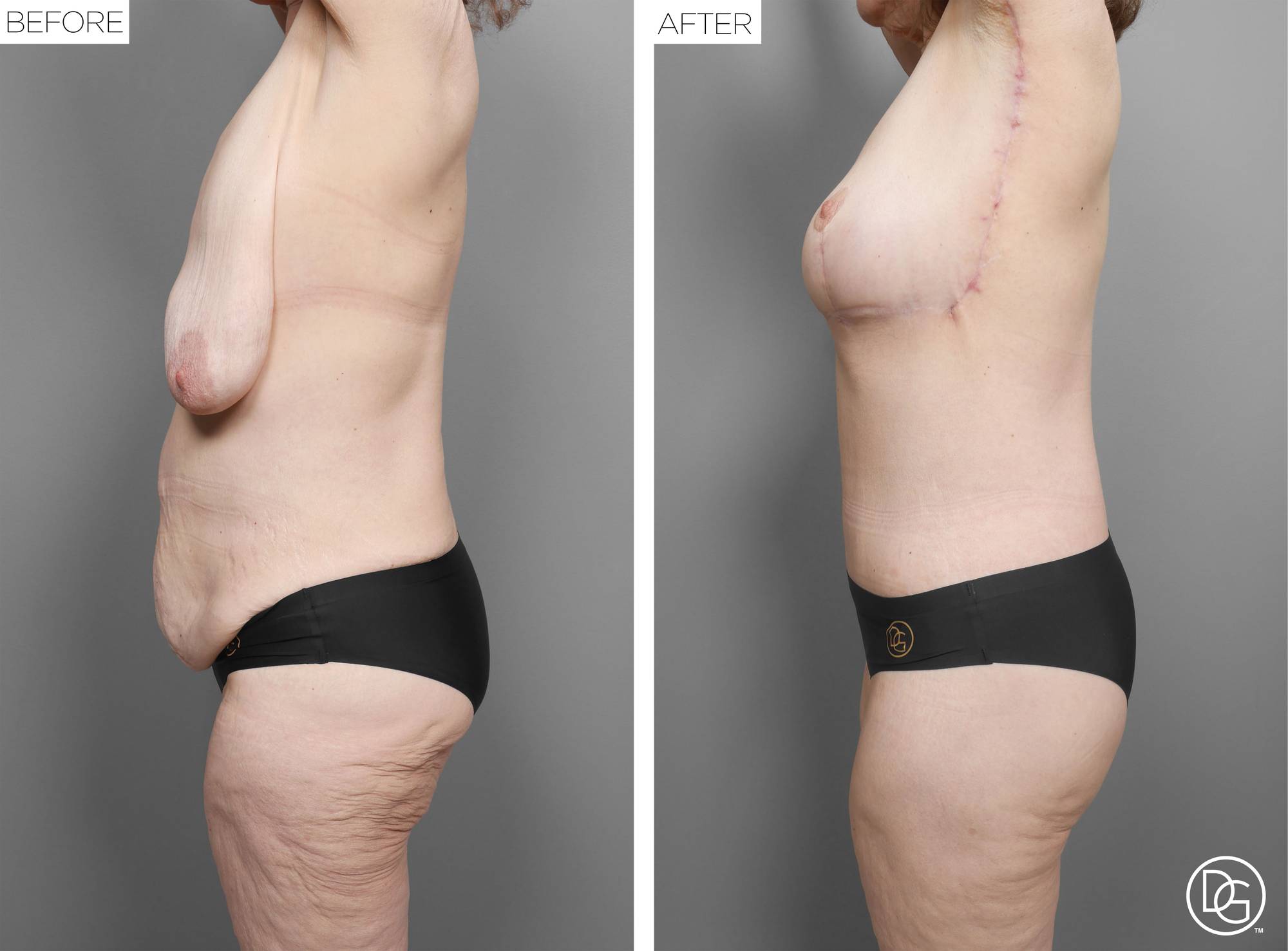 Before & After Image