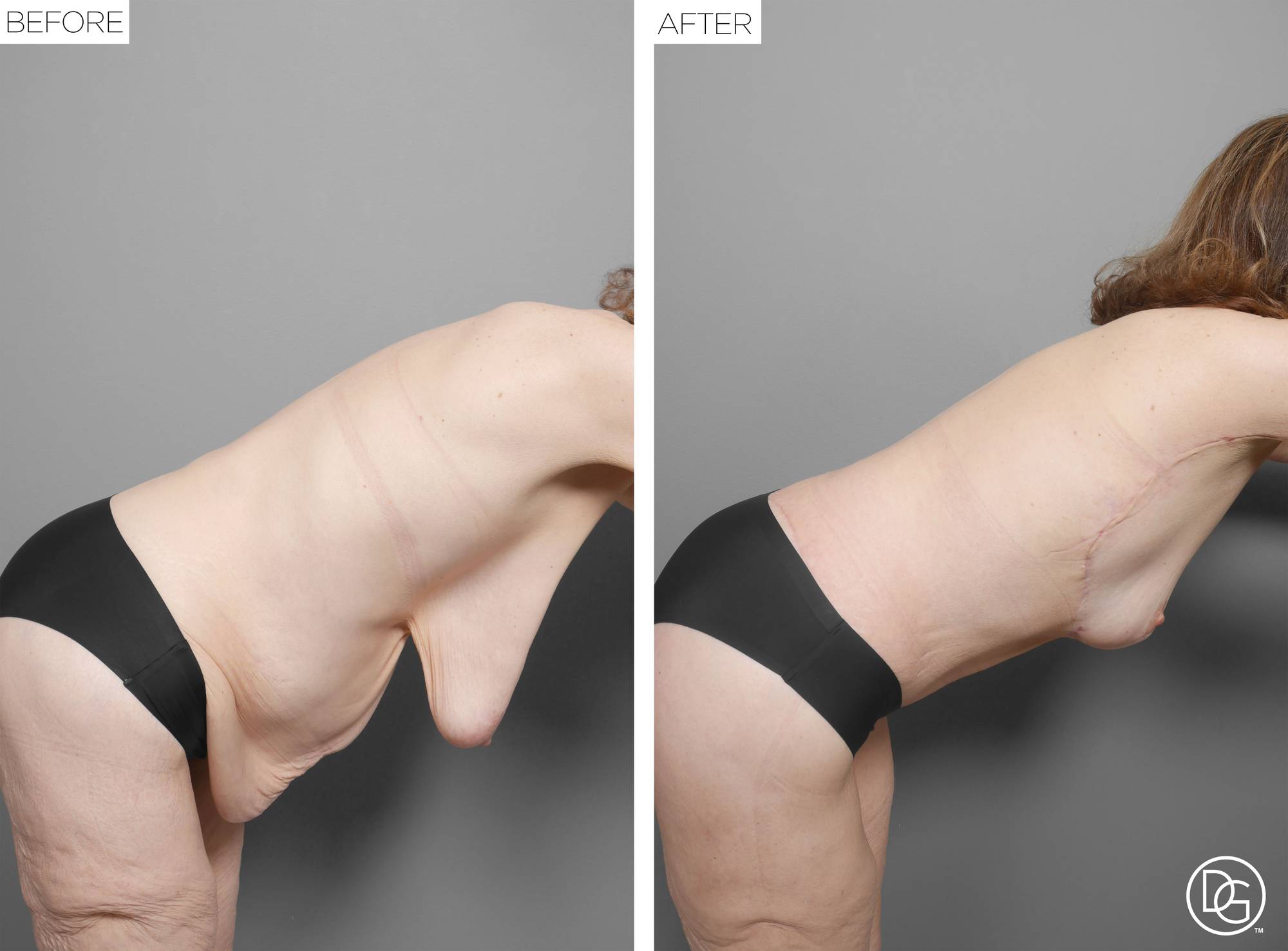 Before & After Image