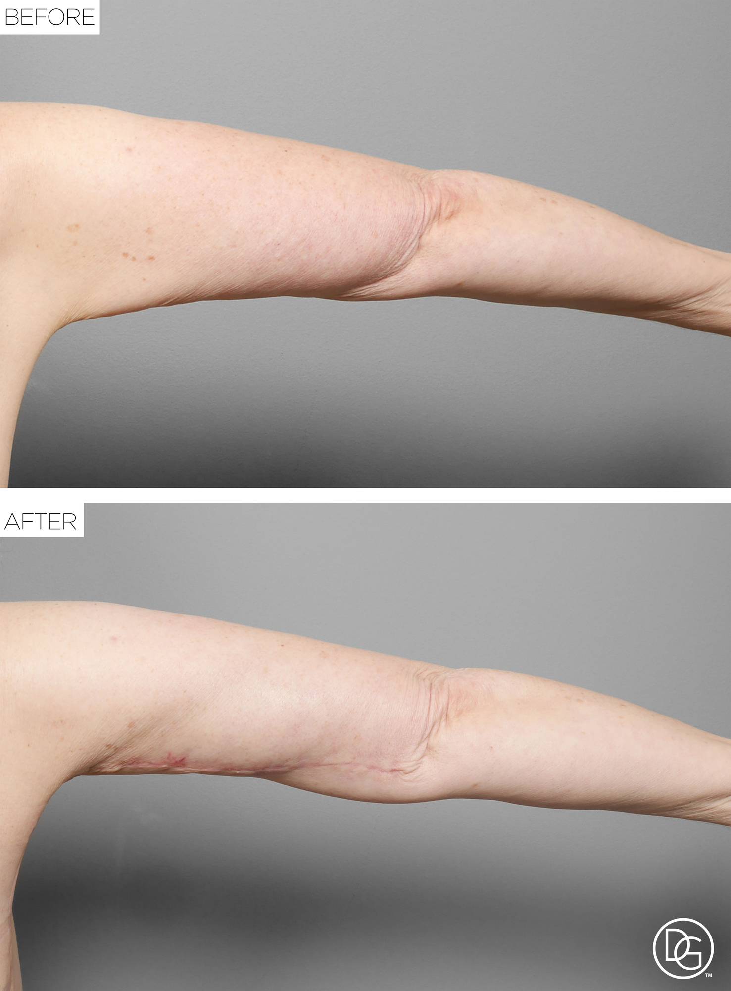 Before & After Image