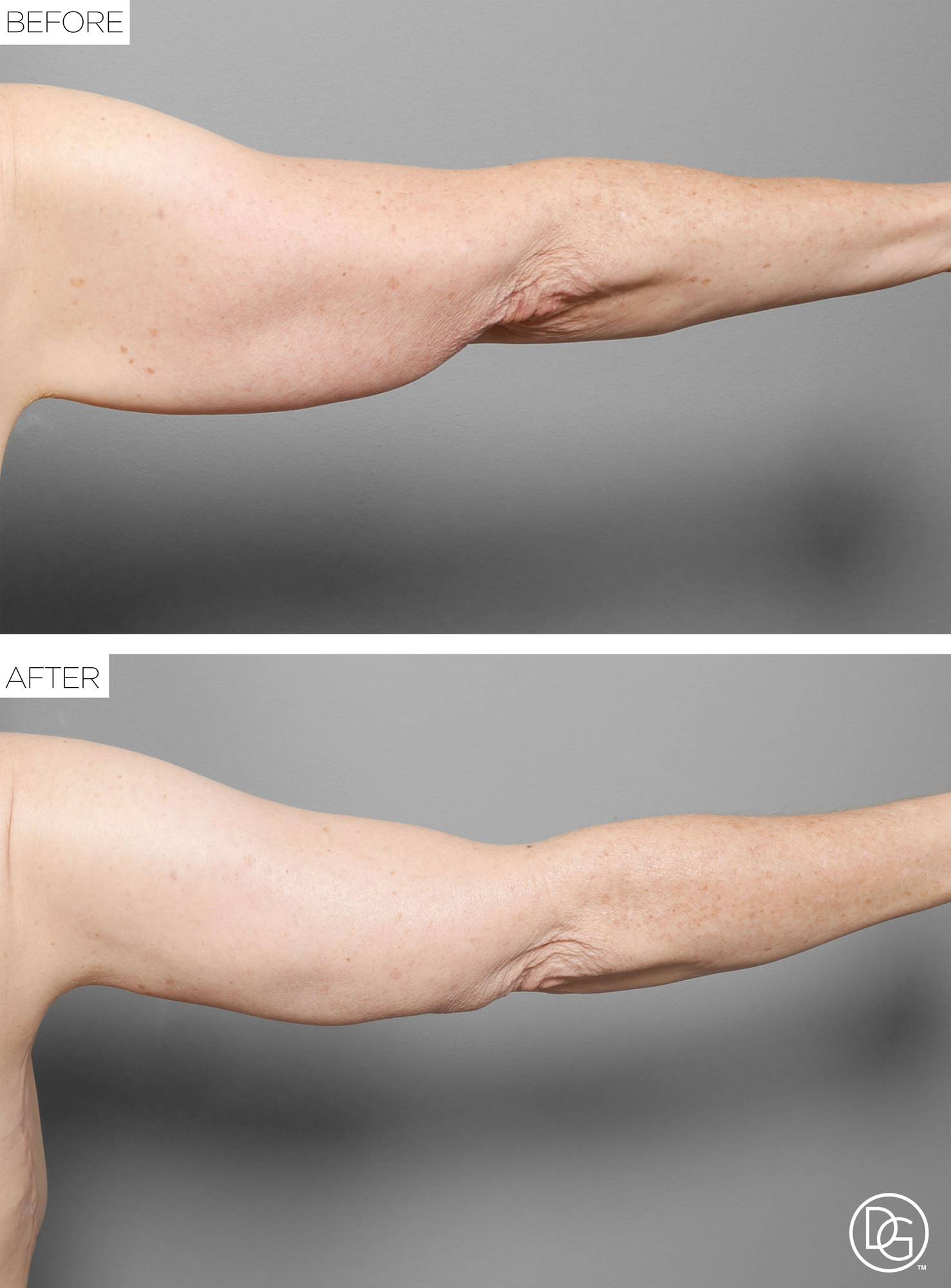 Before & After Image