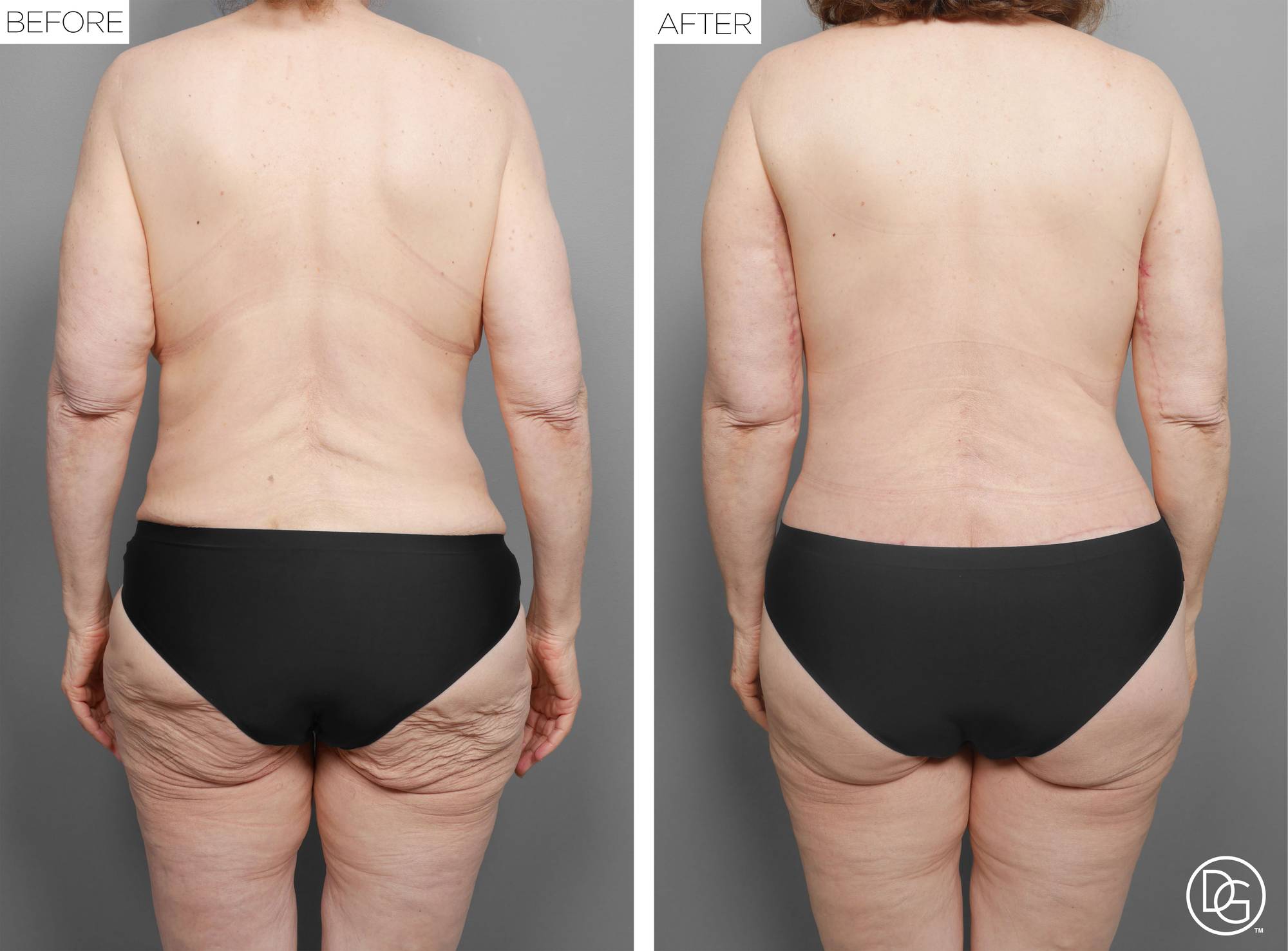 Before & After Image