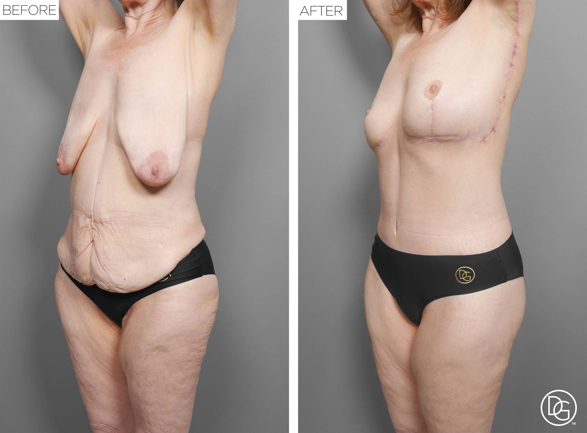 Before & After Image
