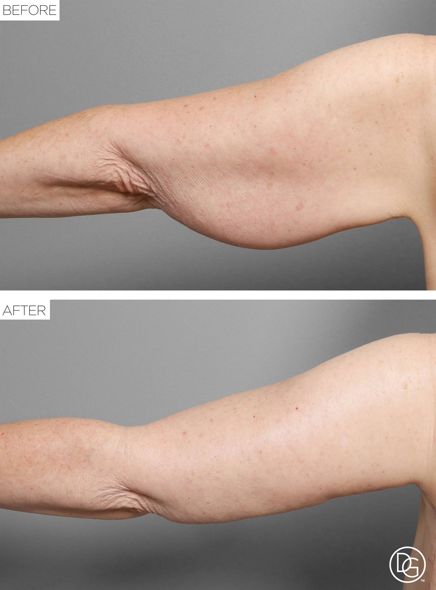 Before & After Image