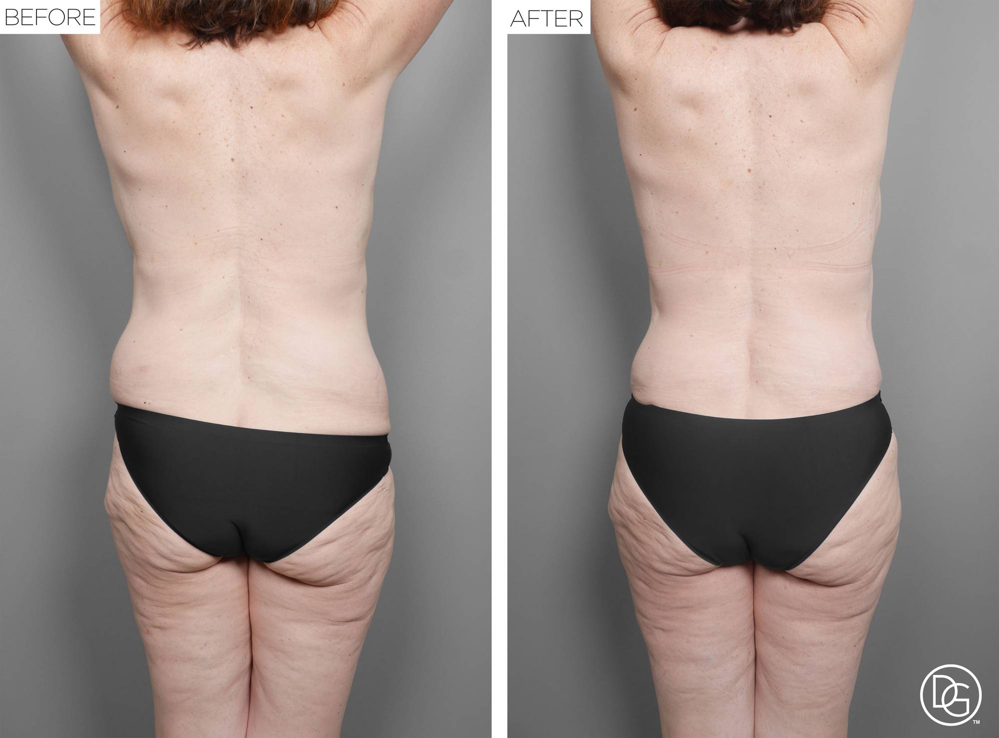 Before & After Image