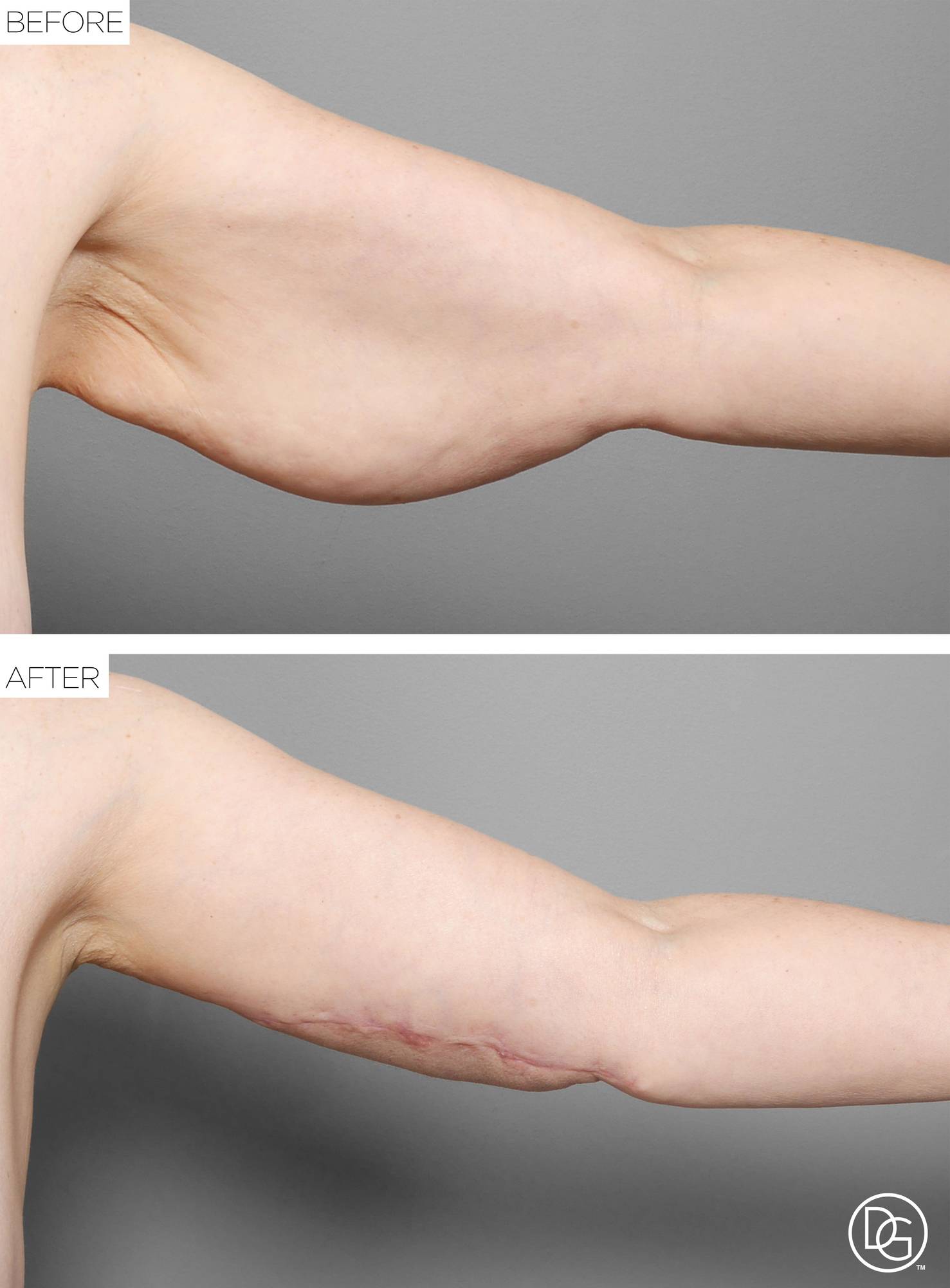 Before & After Image