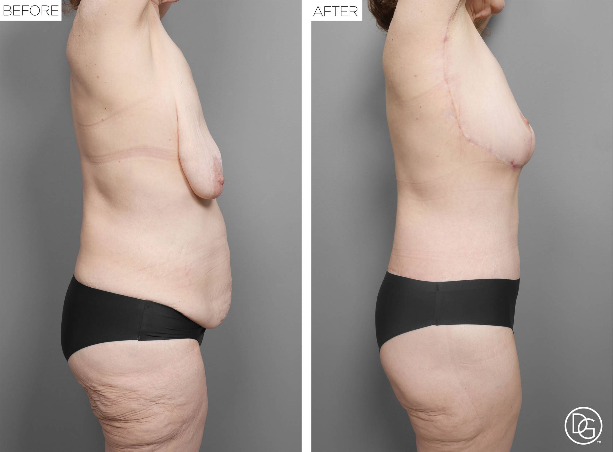 Before & After Image