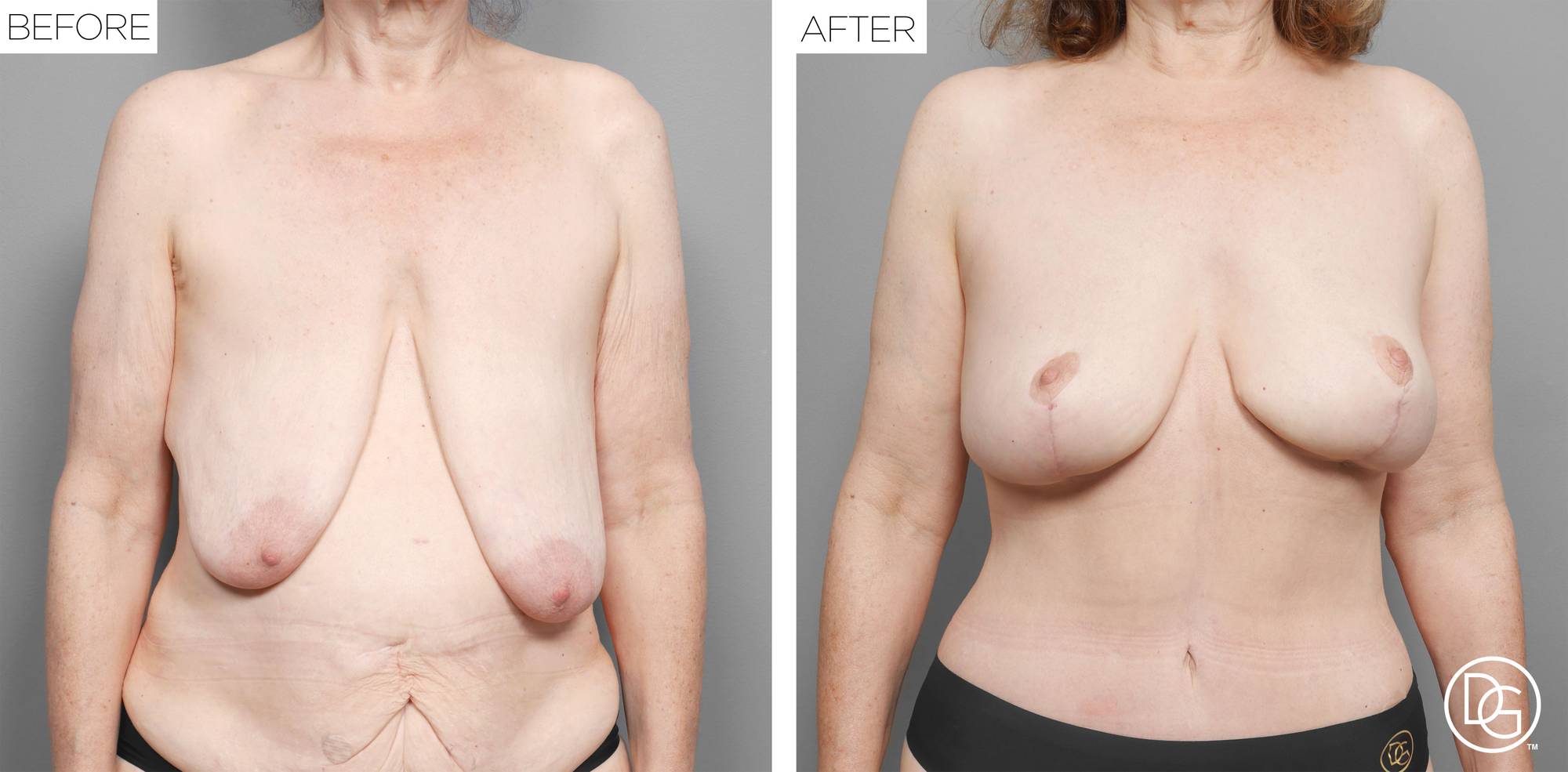 Before & After Image