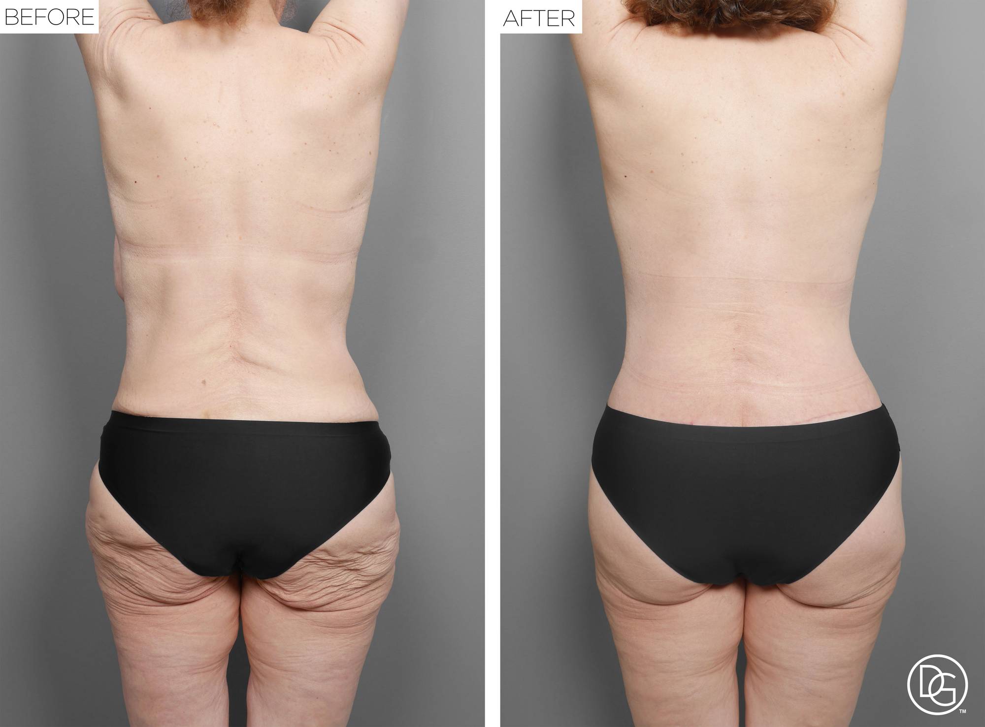 Before & After Image