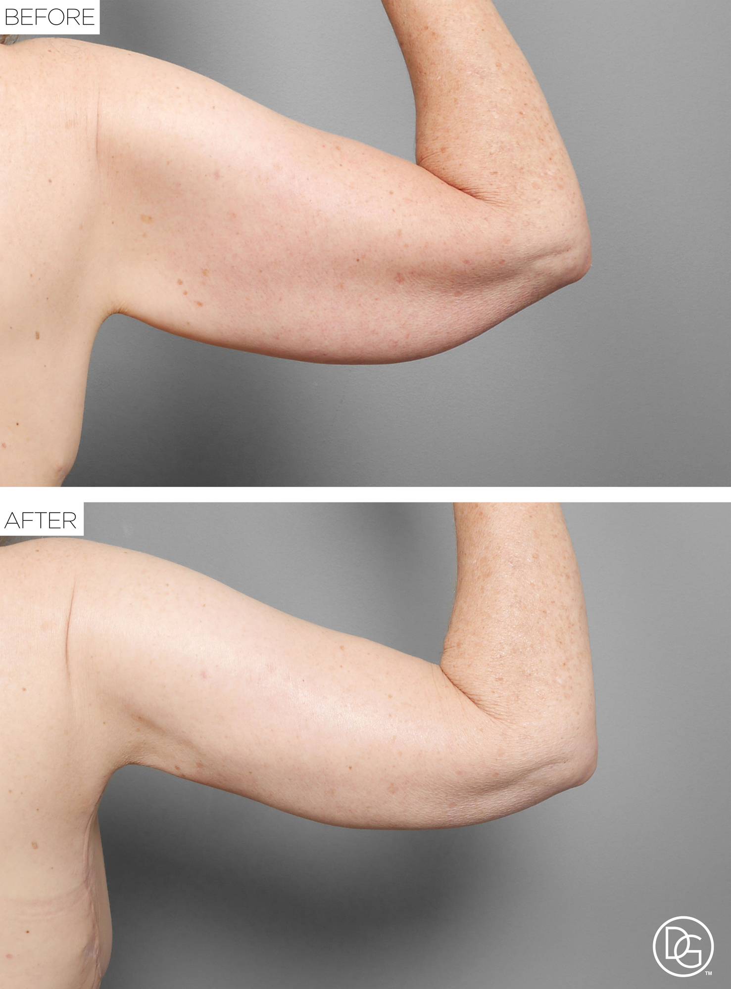 Before & After Image