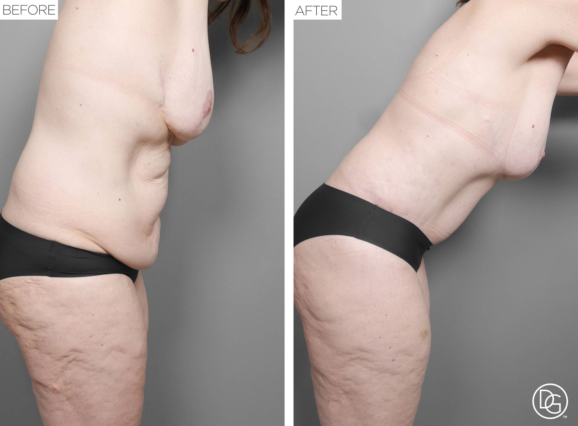 Before & After Image