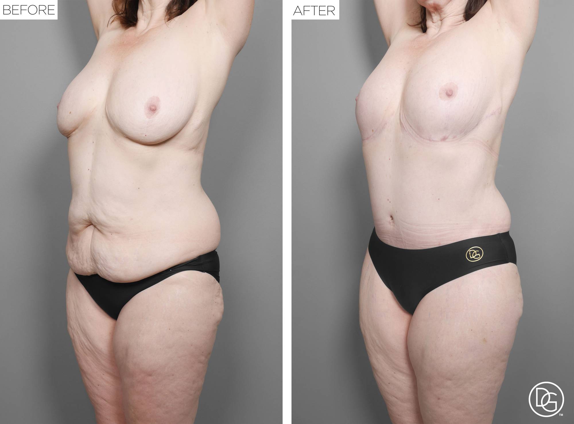 Before & After Image
