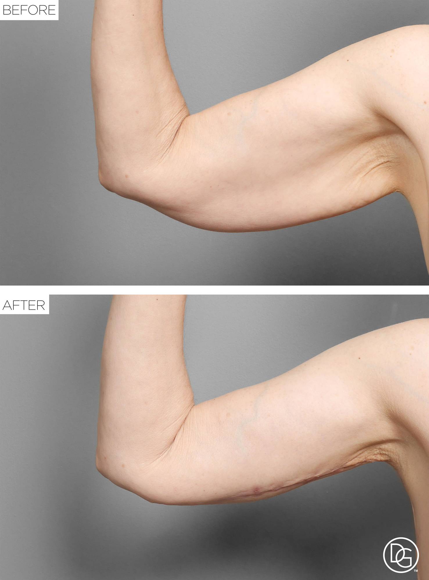 Before & After Image