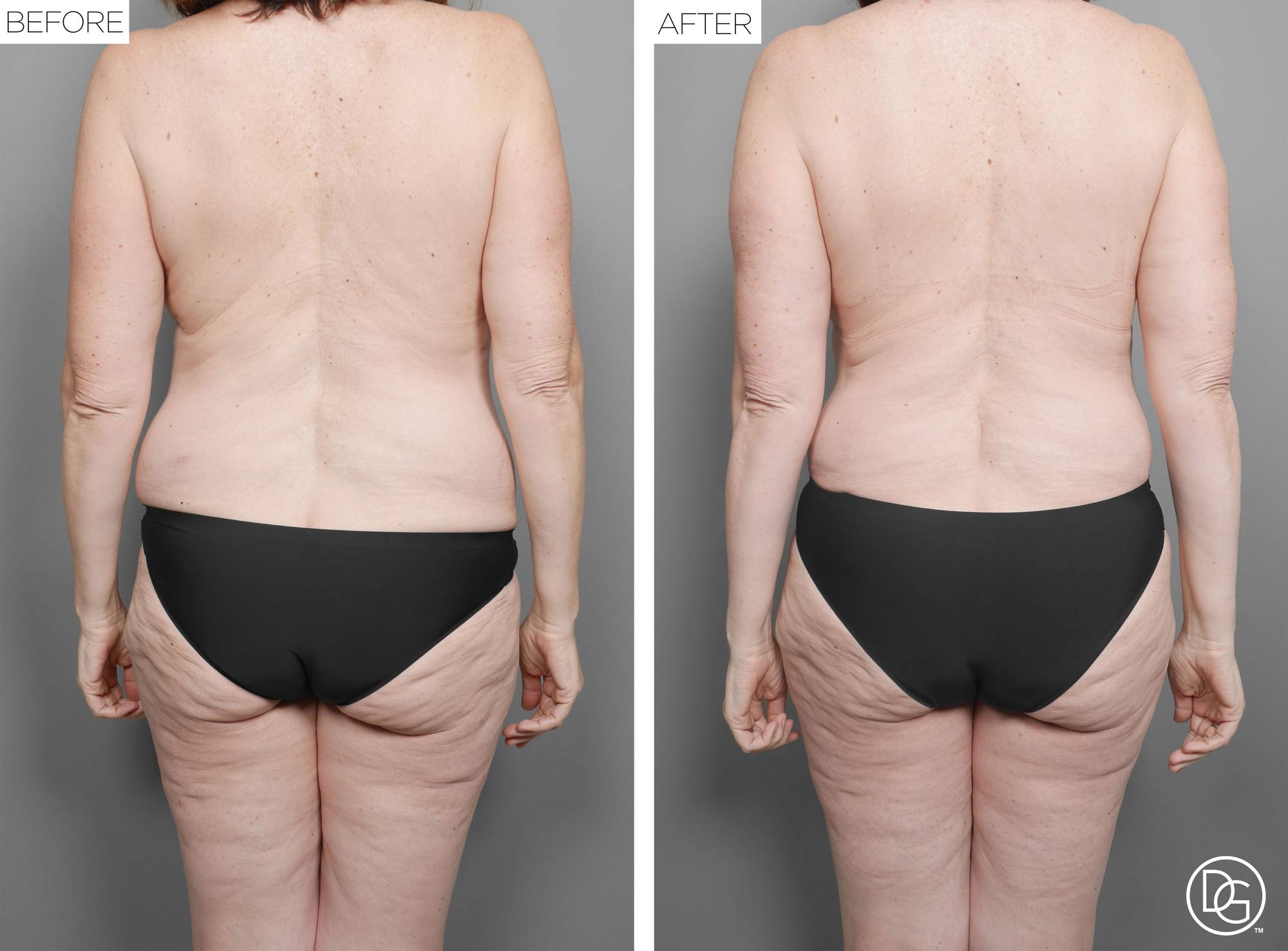 Before & After Image