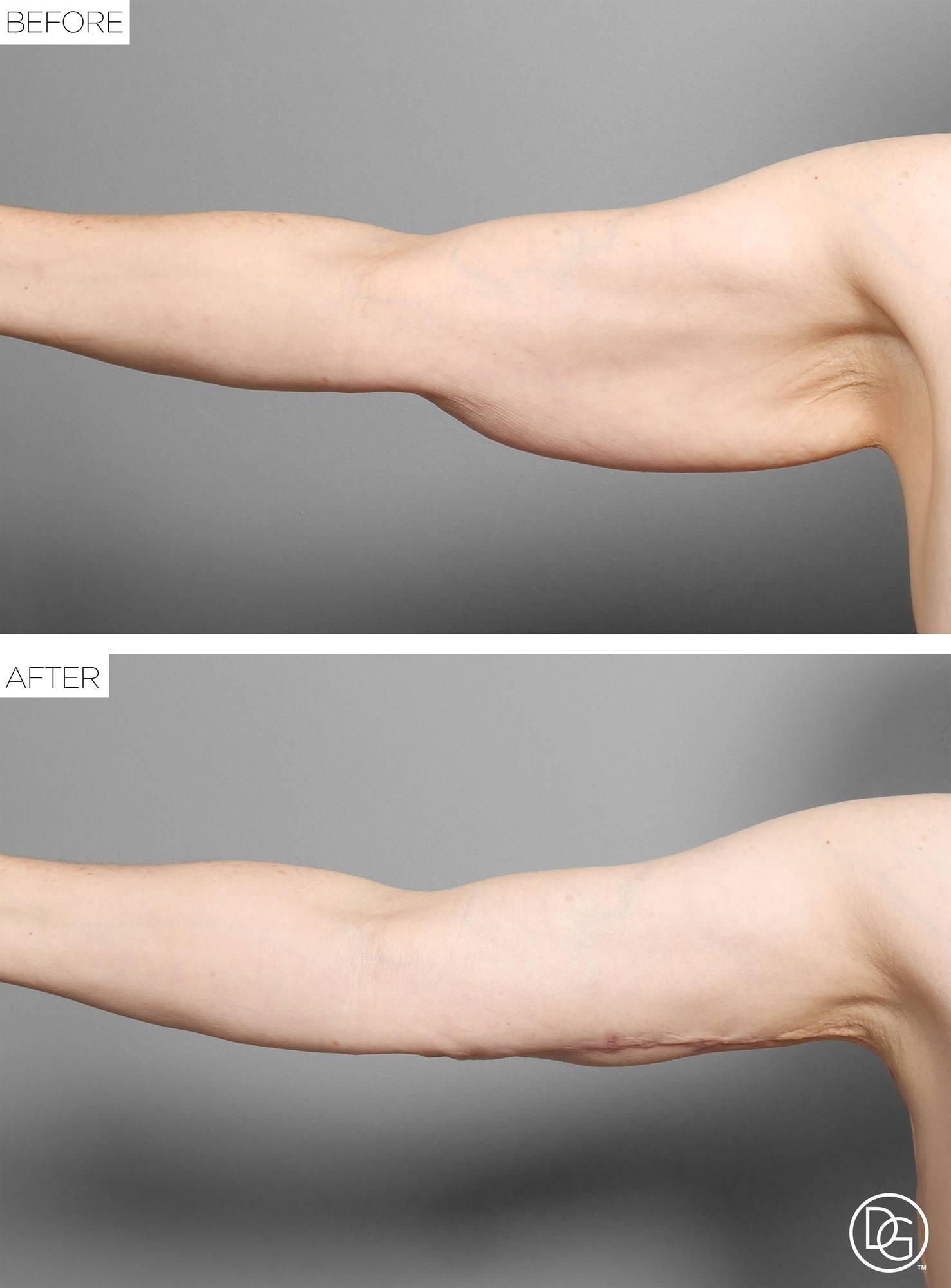 Before & After Image
