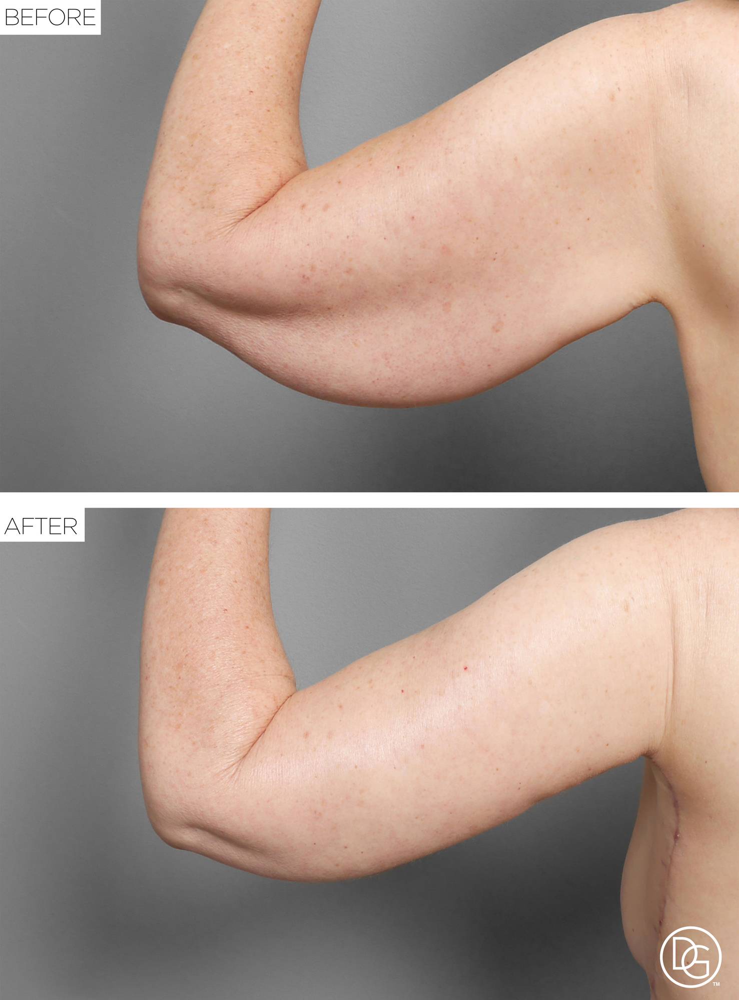 Before & After Image