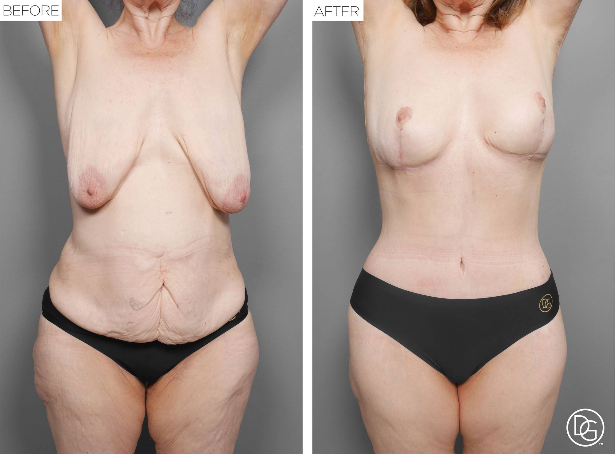Before & After Image