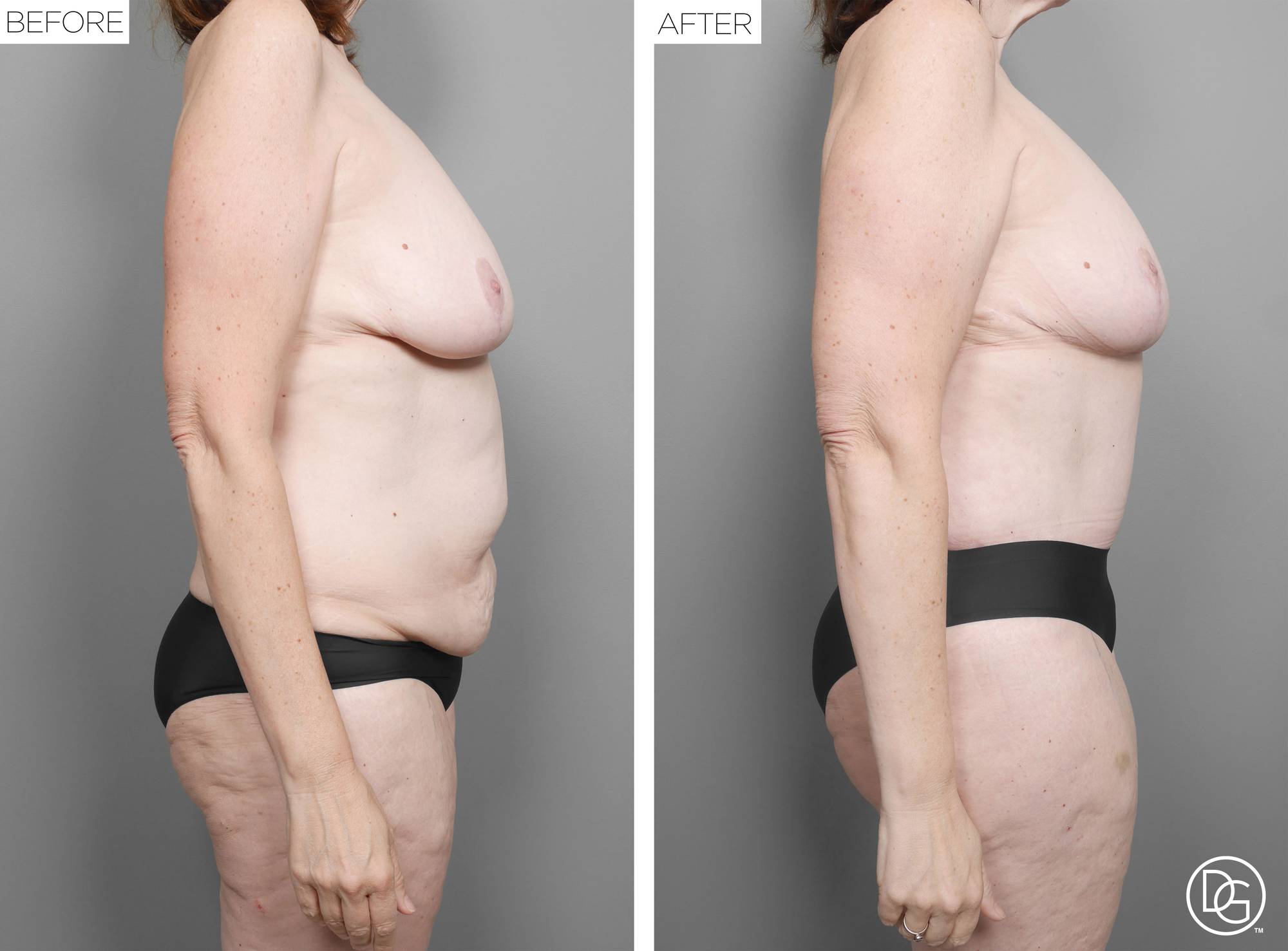 Before & After Image