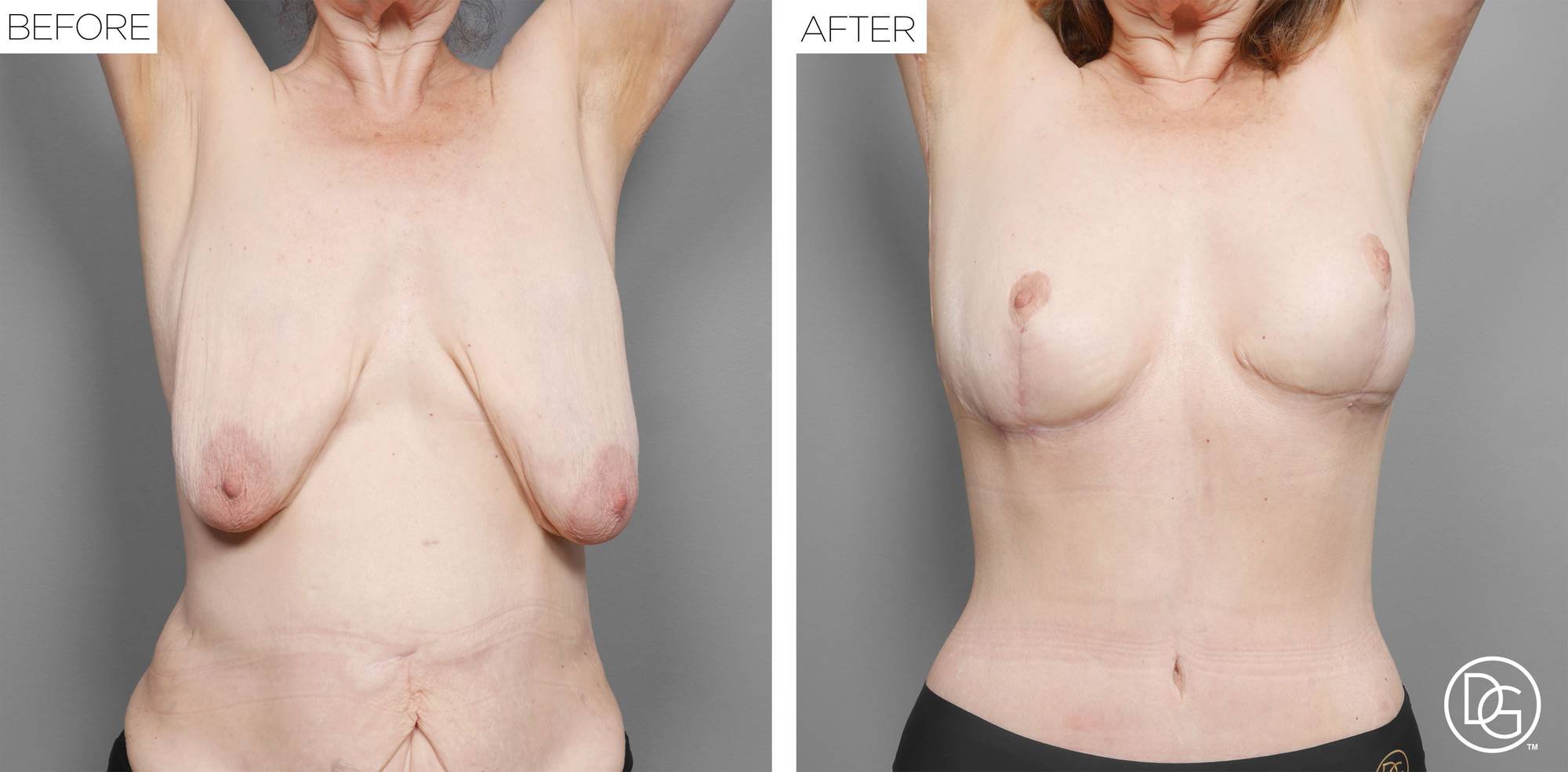 Before & After Image