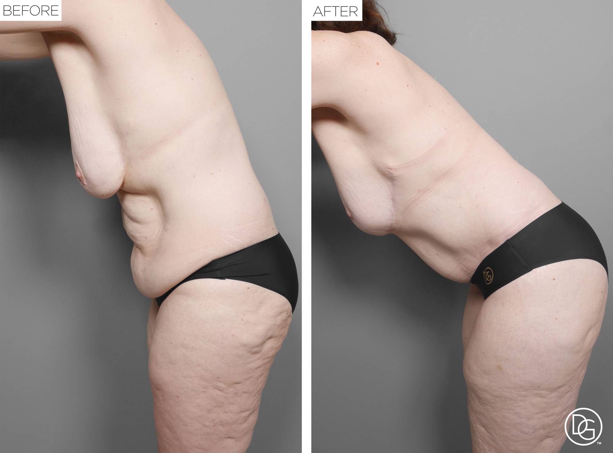 Before & After Image