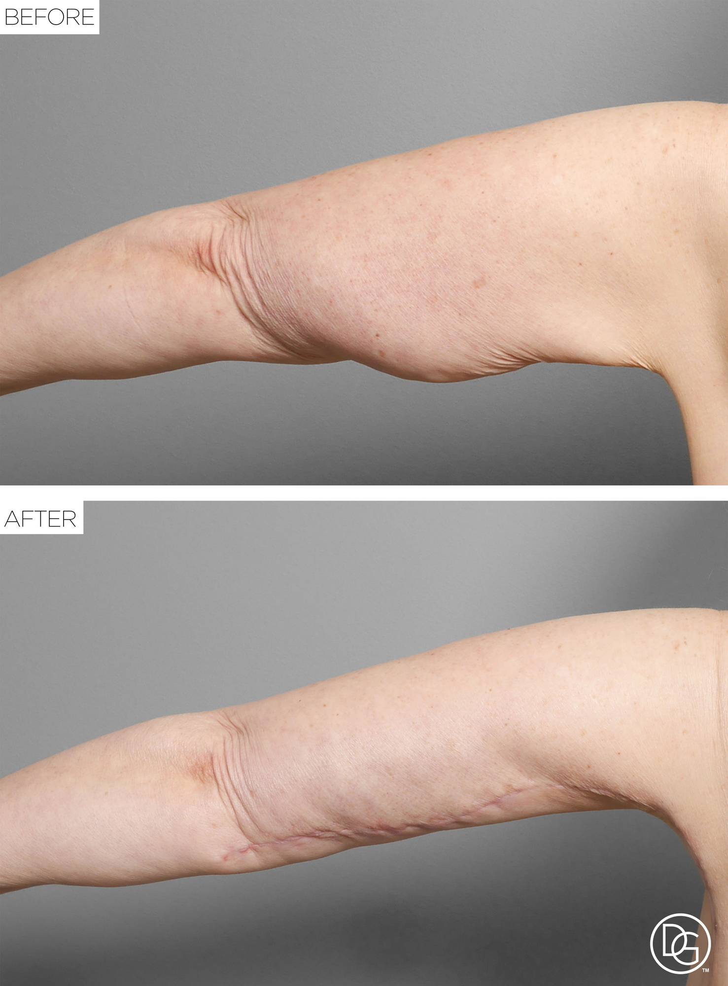 Before & After Image