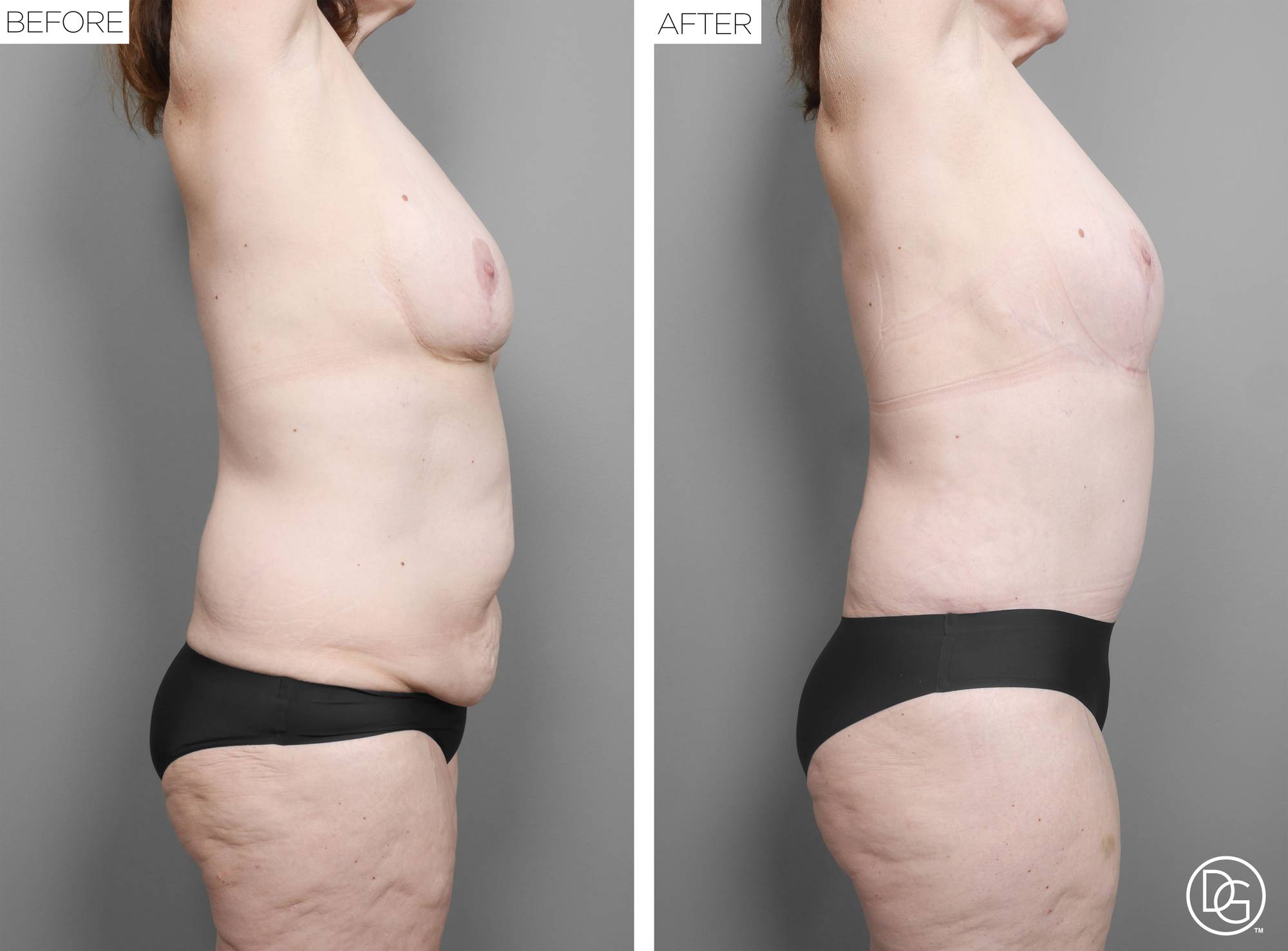 Before & After Image