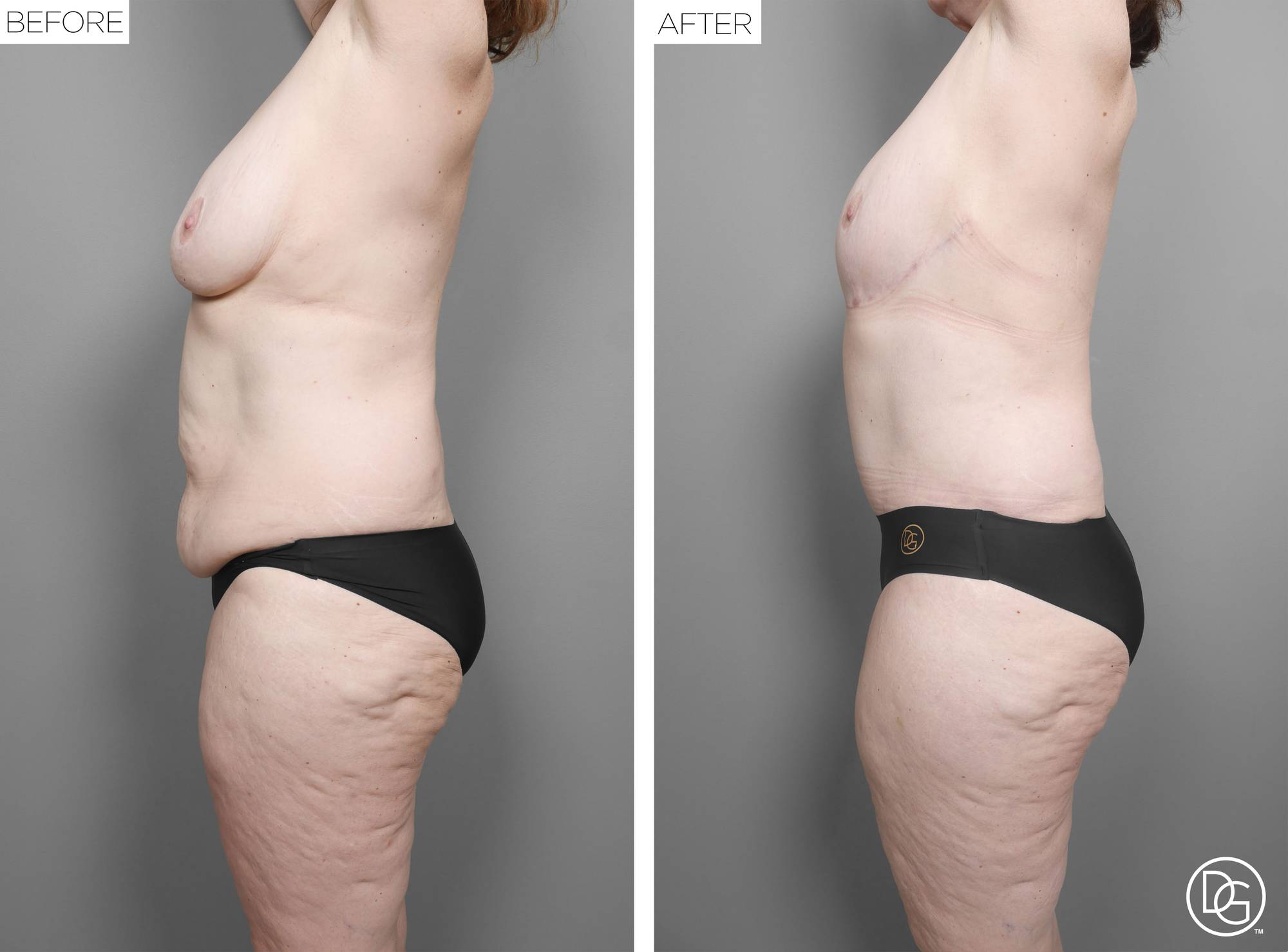 Before & After Image