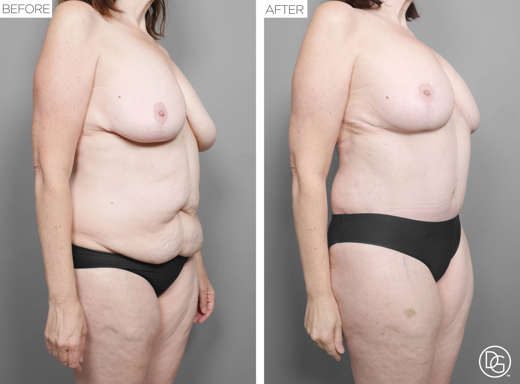 Before & After Image
