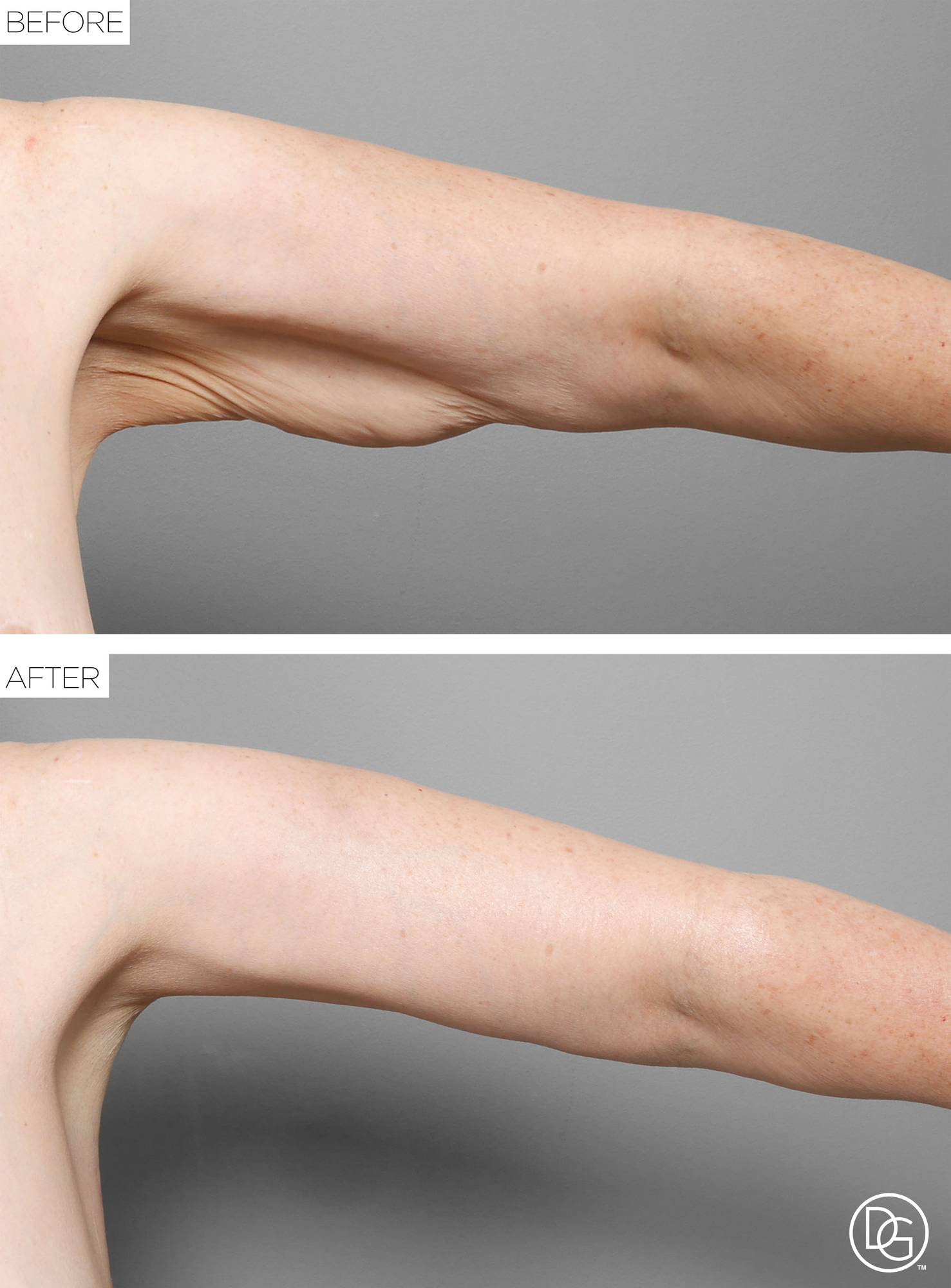Before & After Image