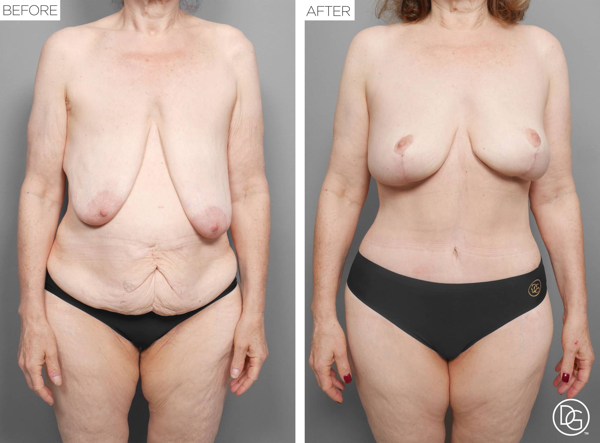 Before & After Image
