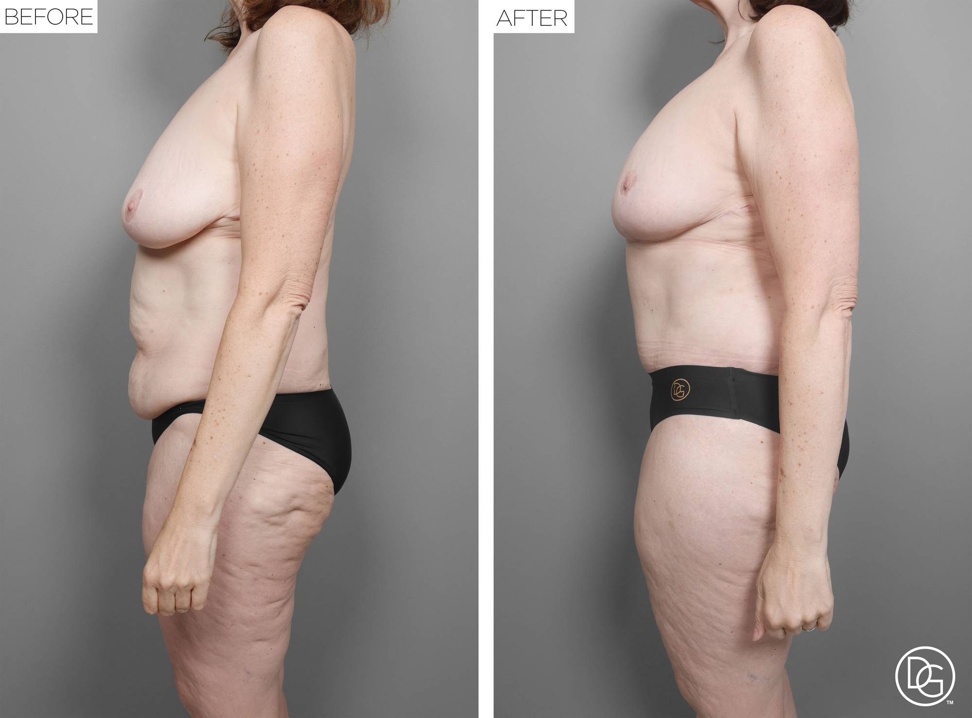 Before & After Image
