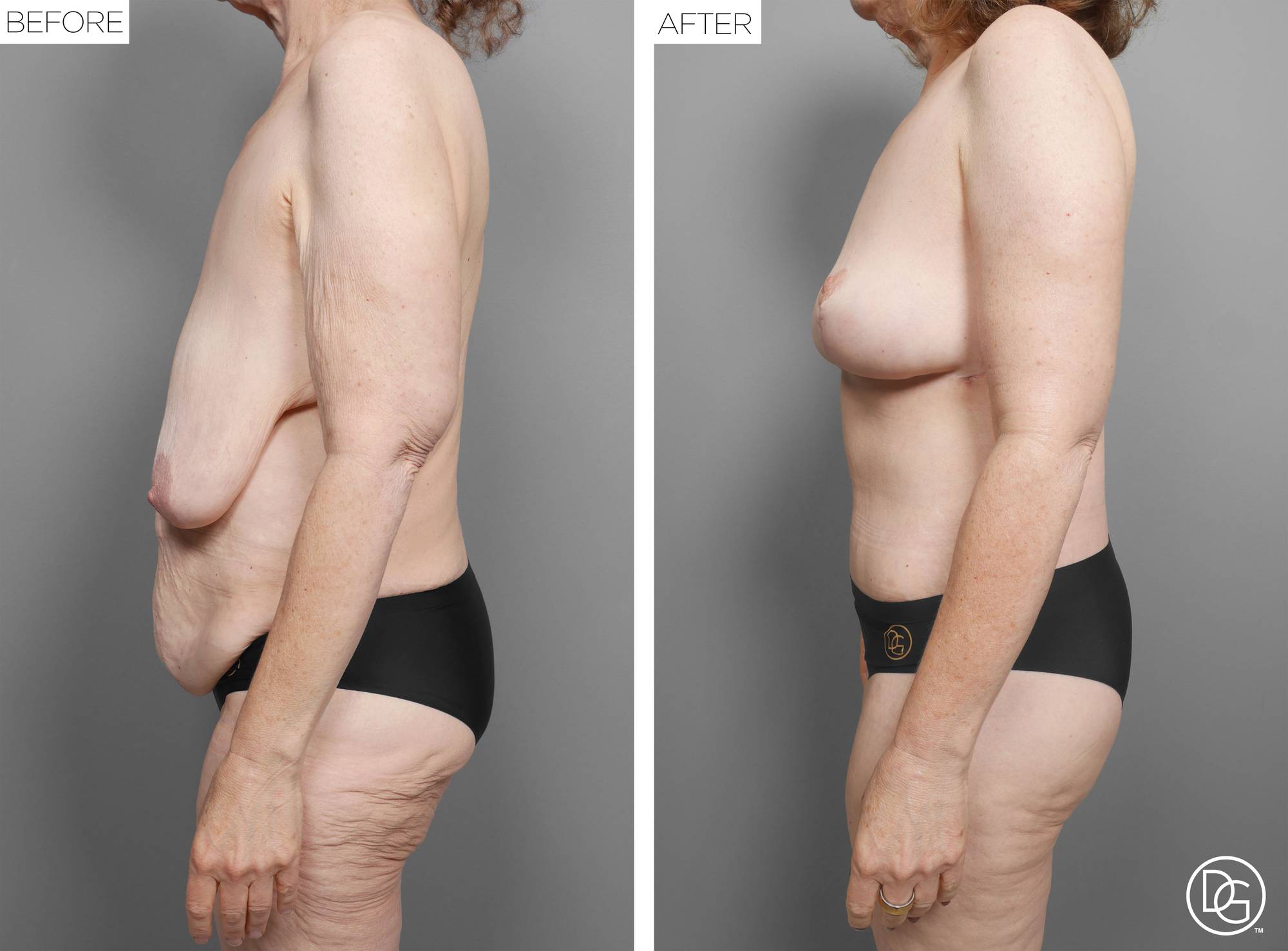 Before & After Image