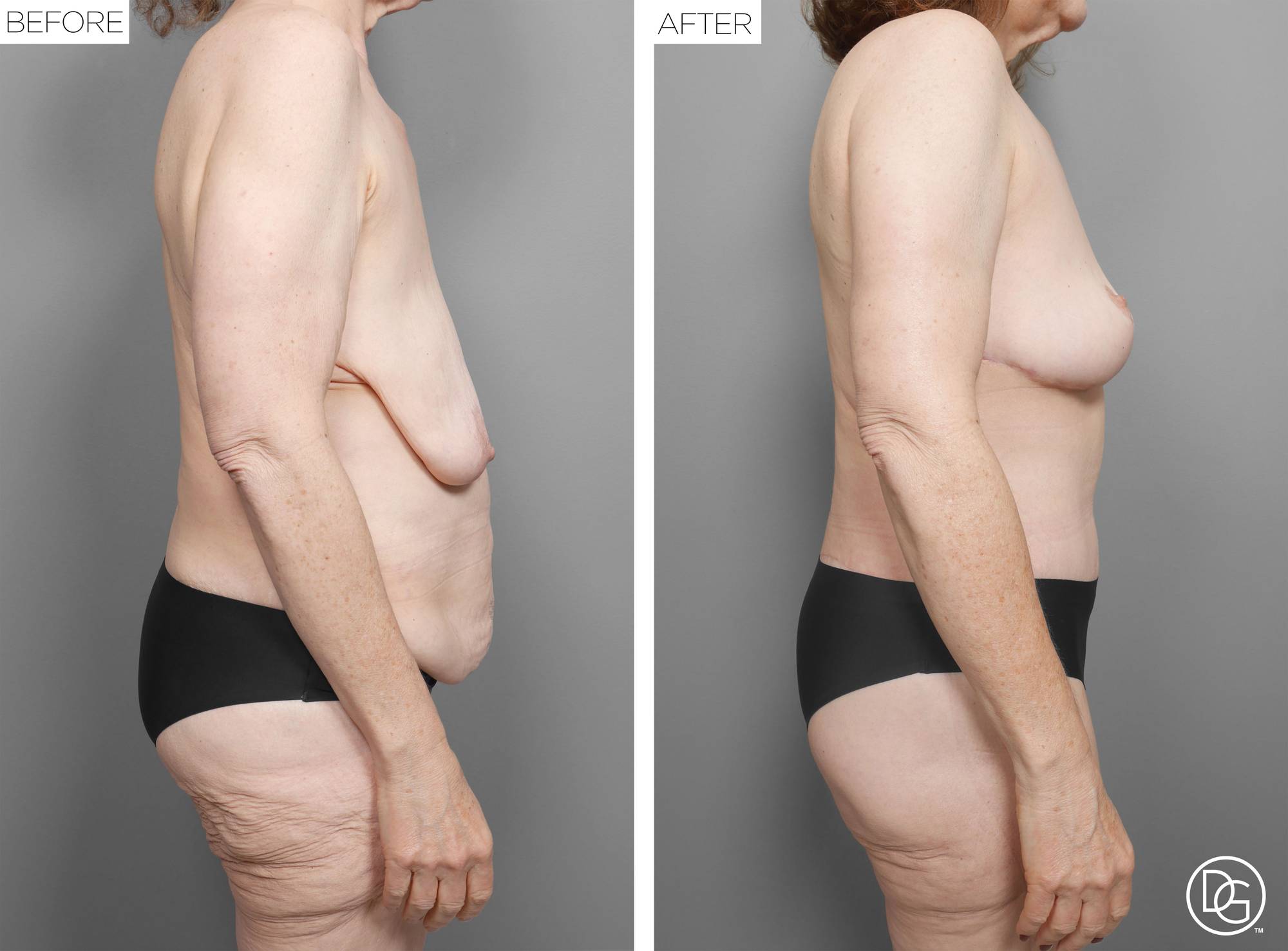 Before & After Image