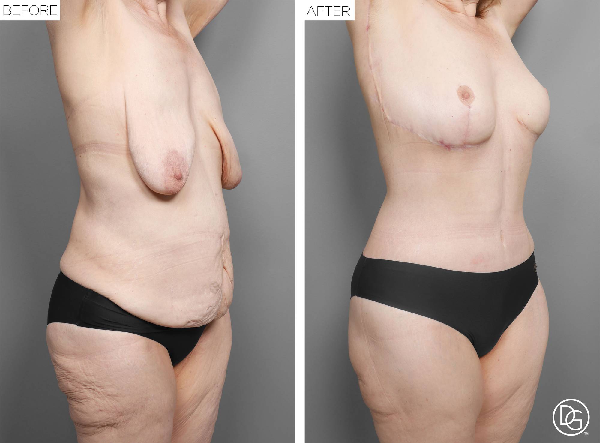 Before & After Image