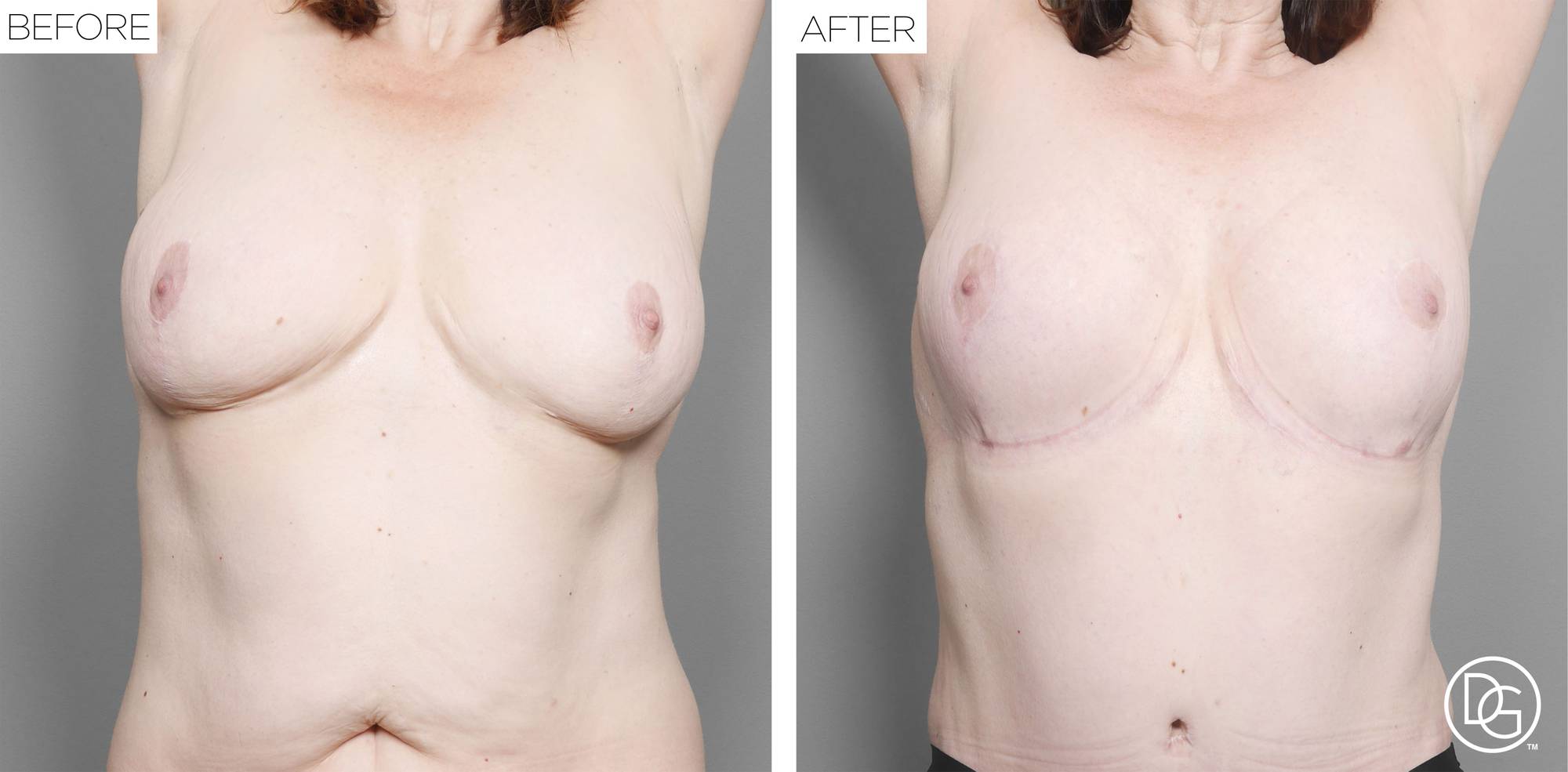 Before & After Image