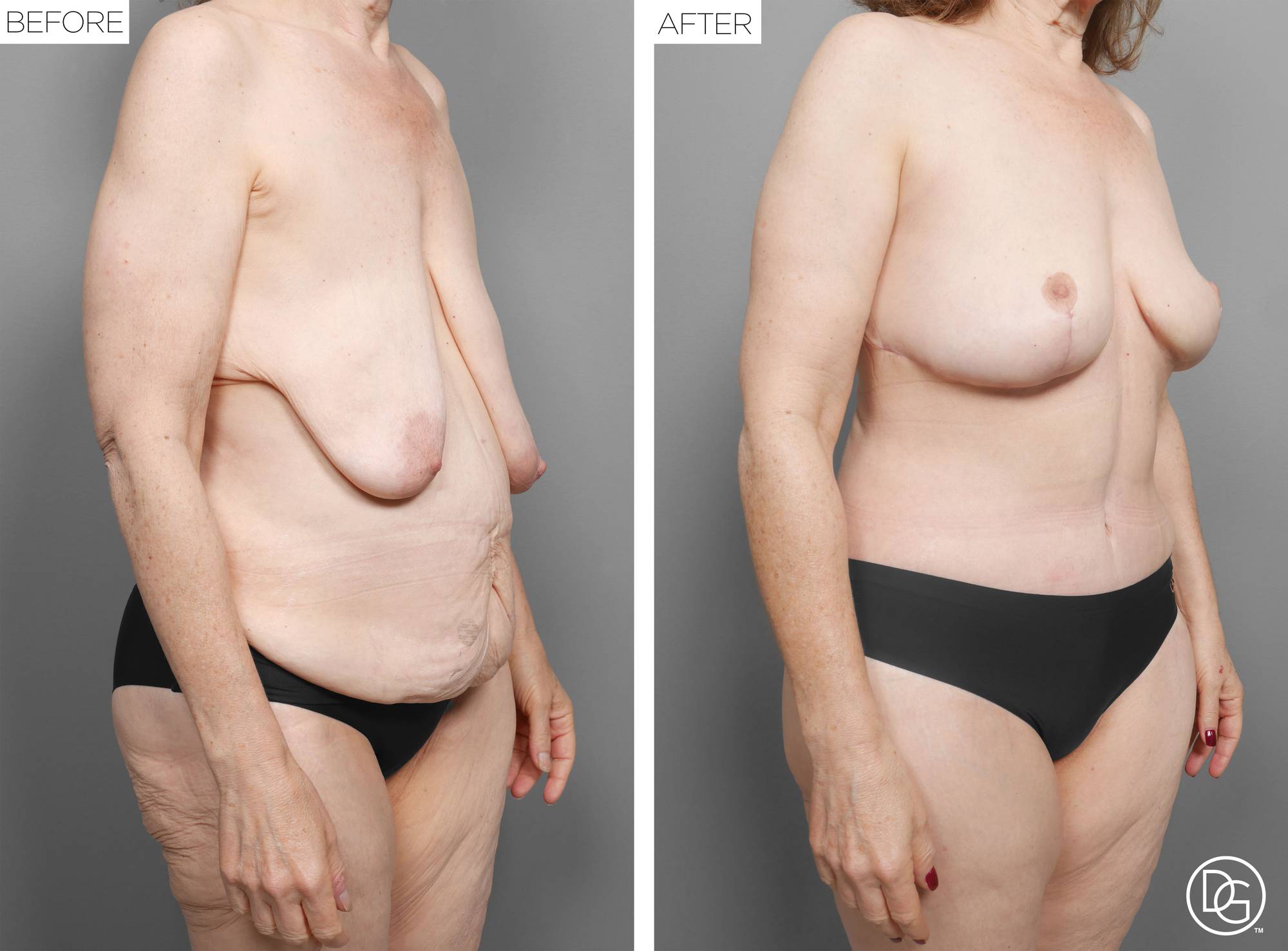 Before & After Image