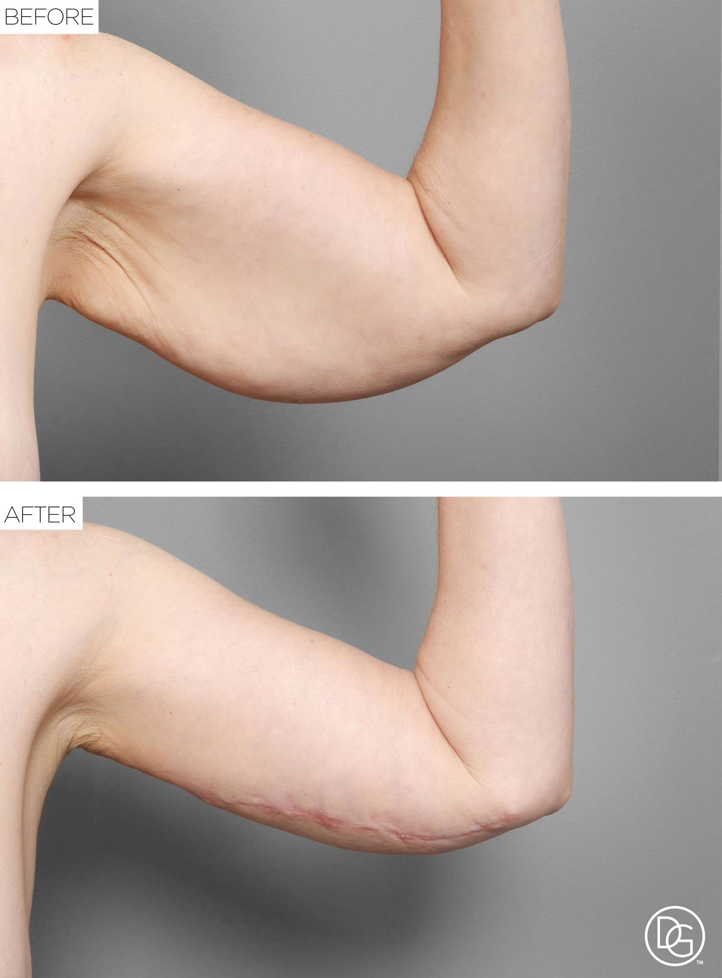 Before & After Image
