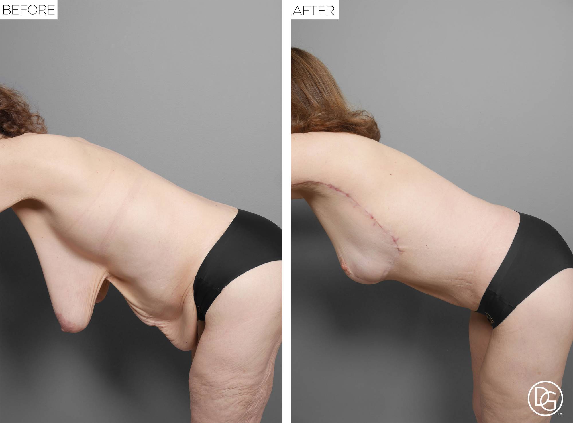 Before & After Image