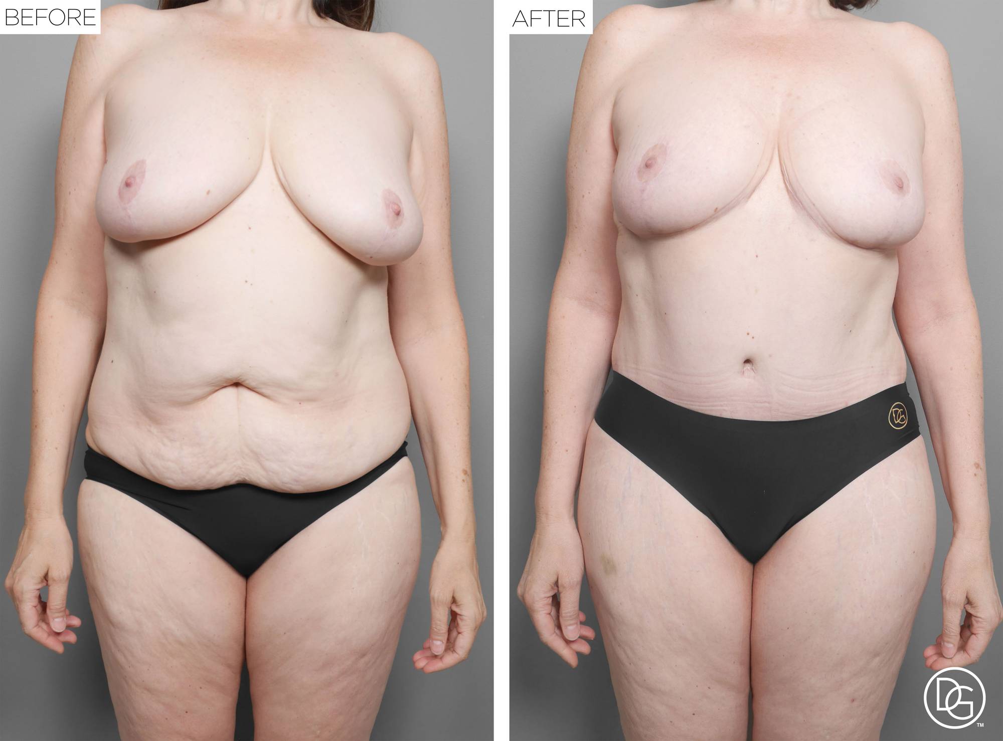 Before & After Image