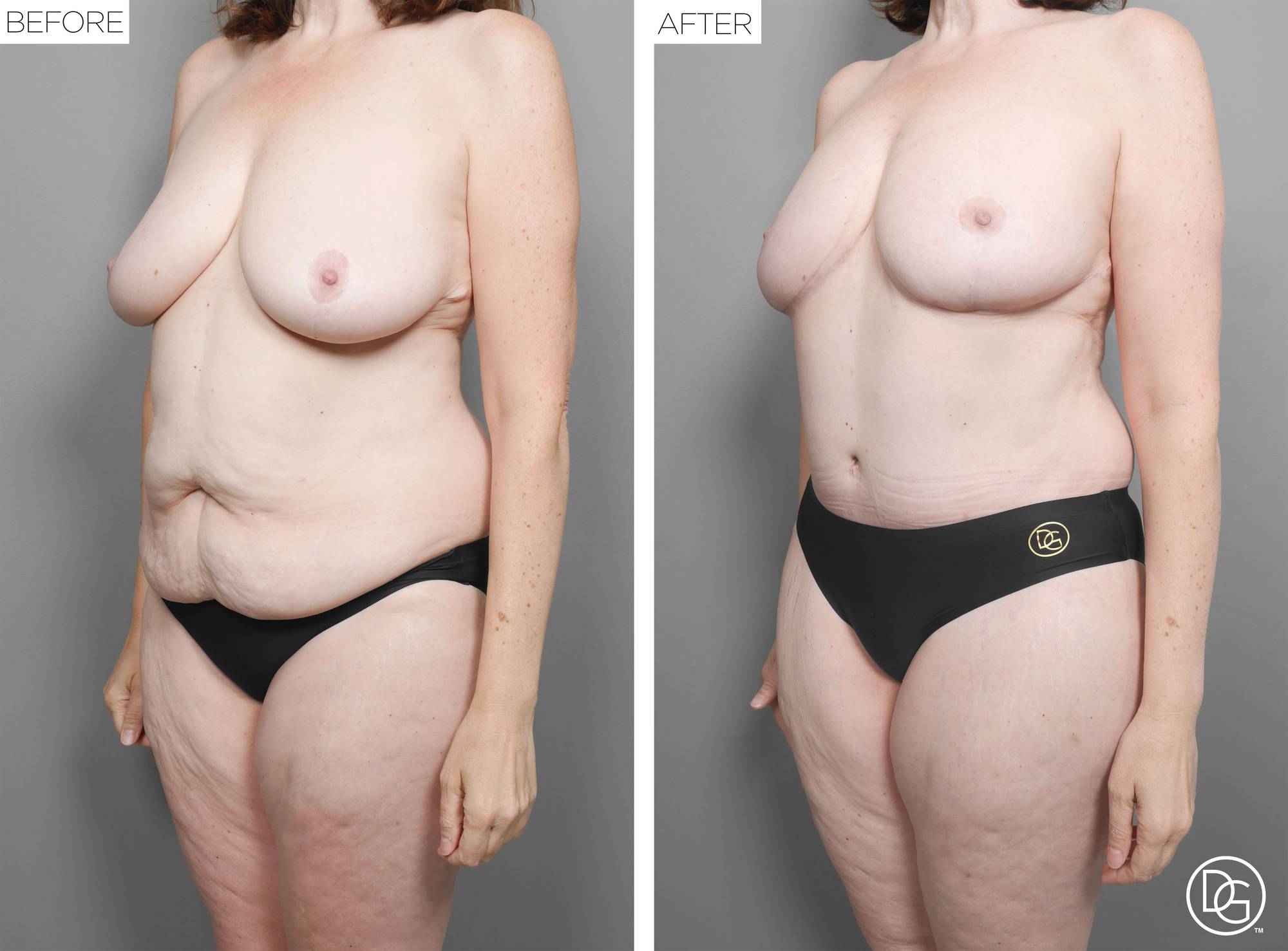 Before & After Image