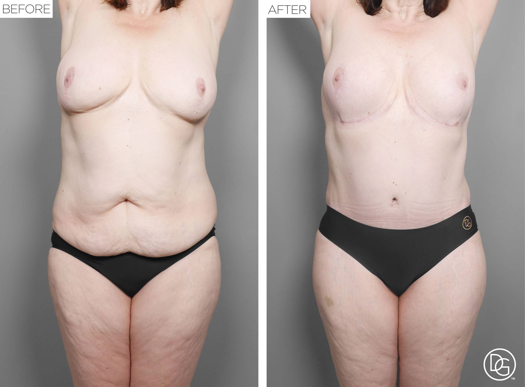 Before & After Image