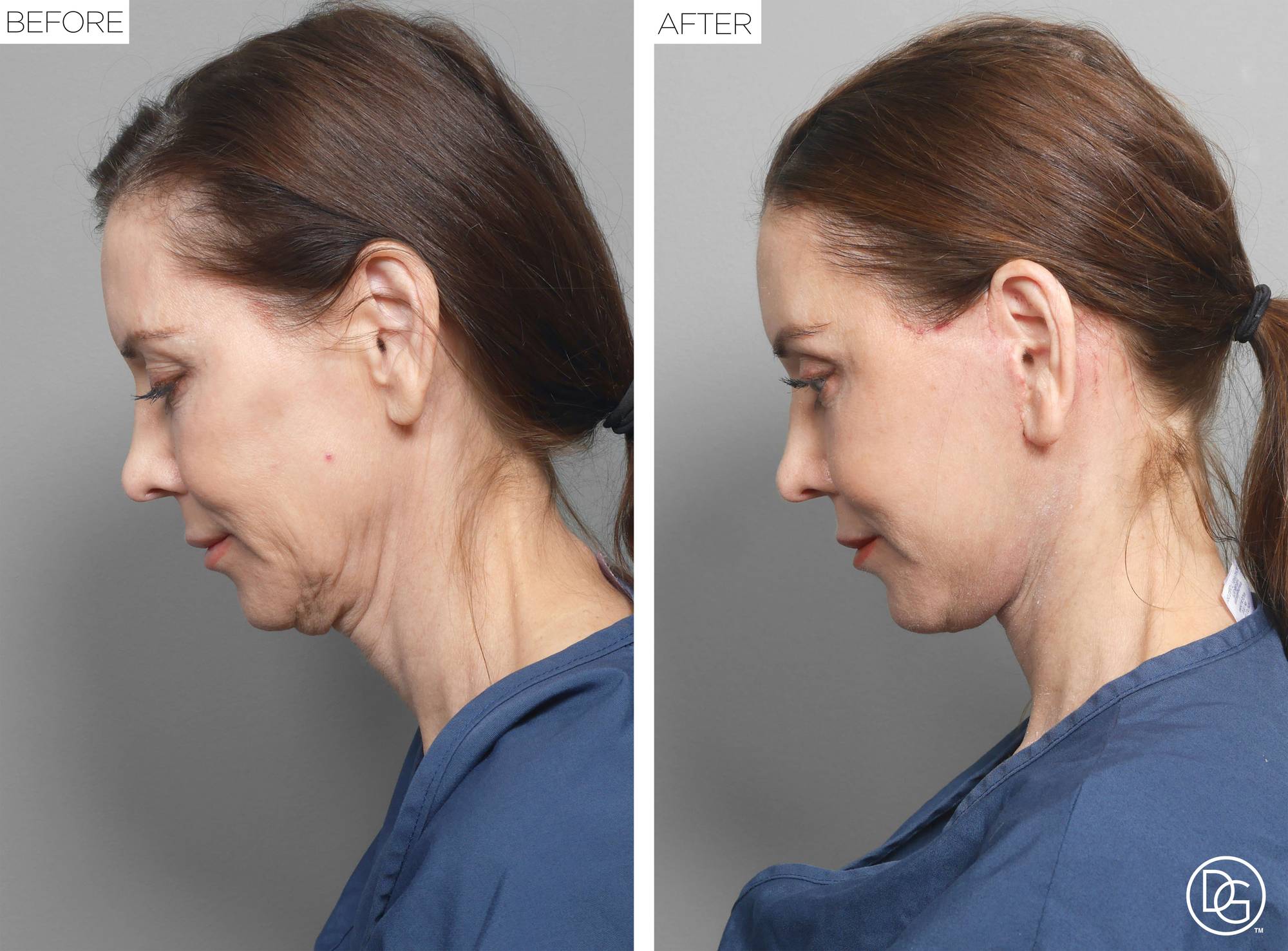 Before & After Image