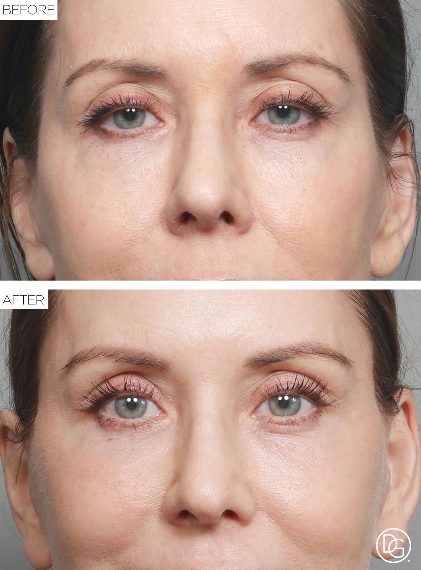Before & After Image