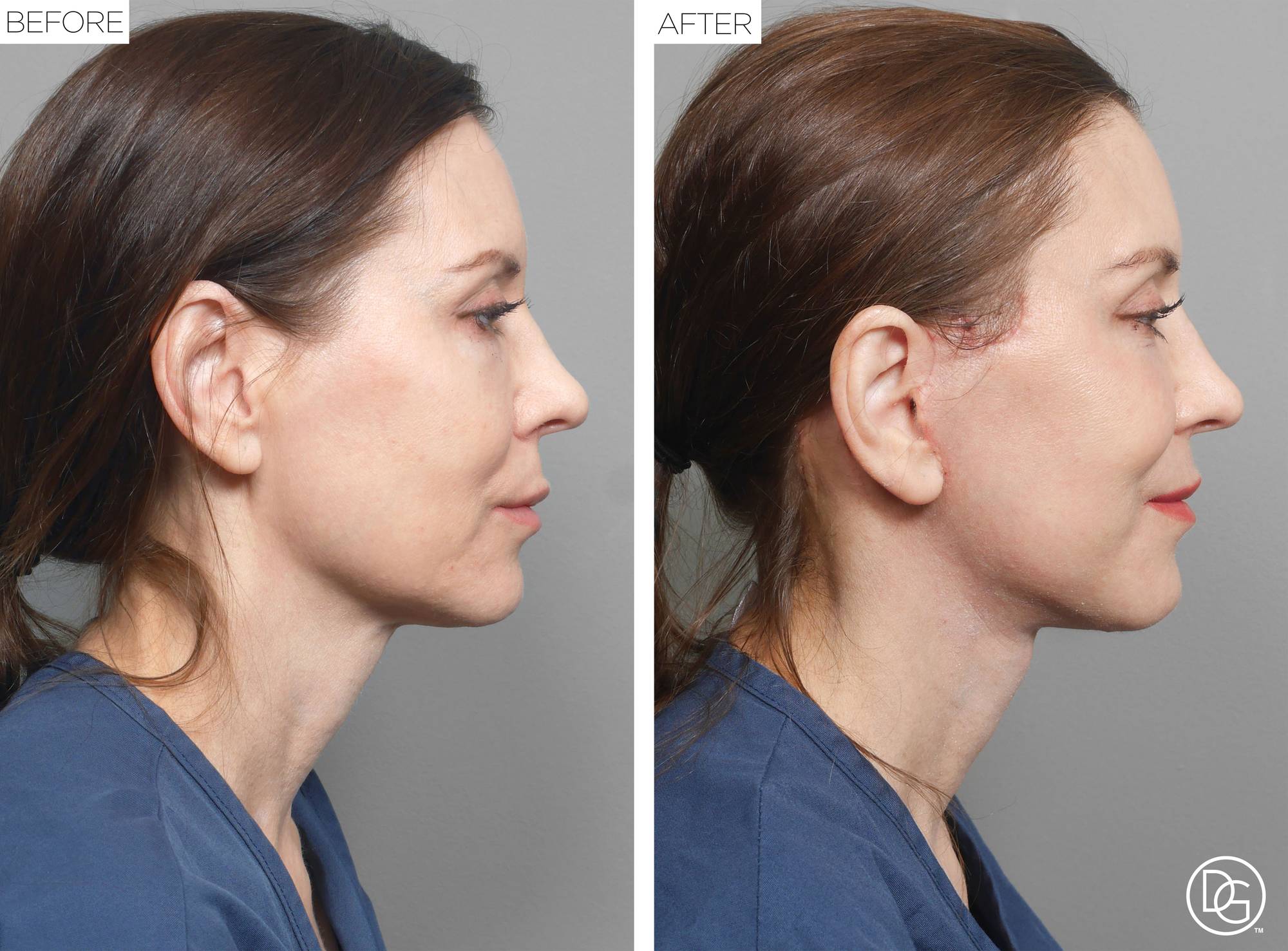 Before & After Image