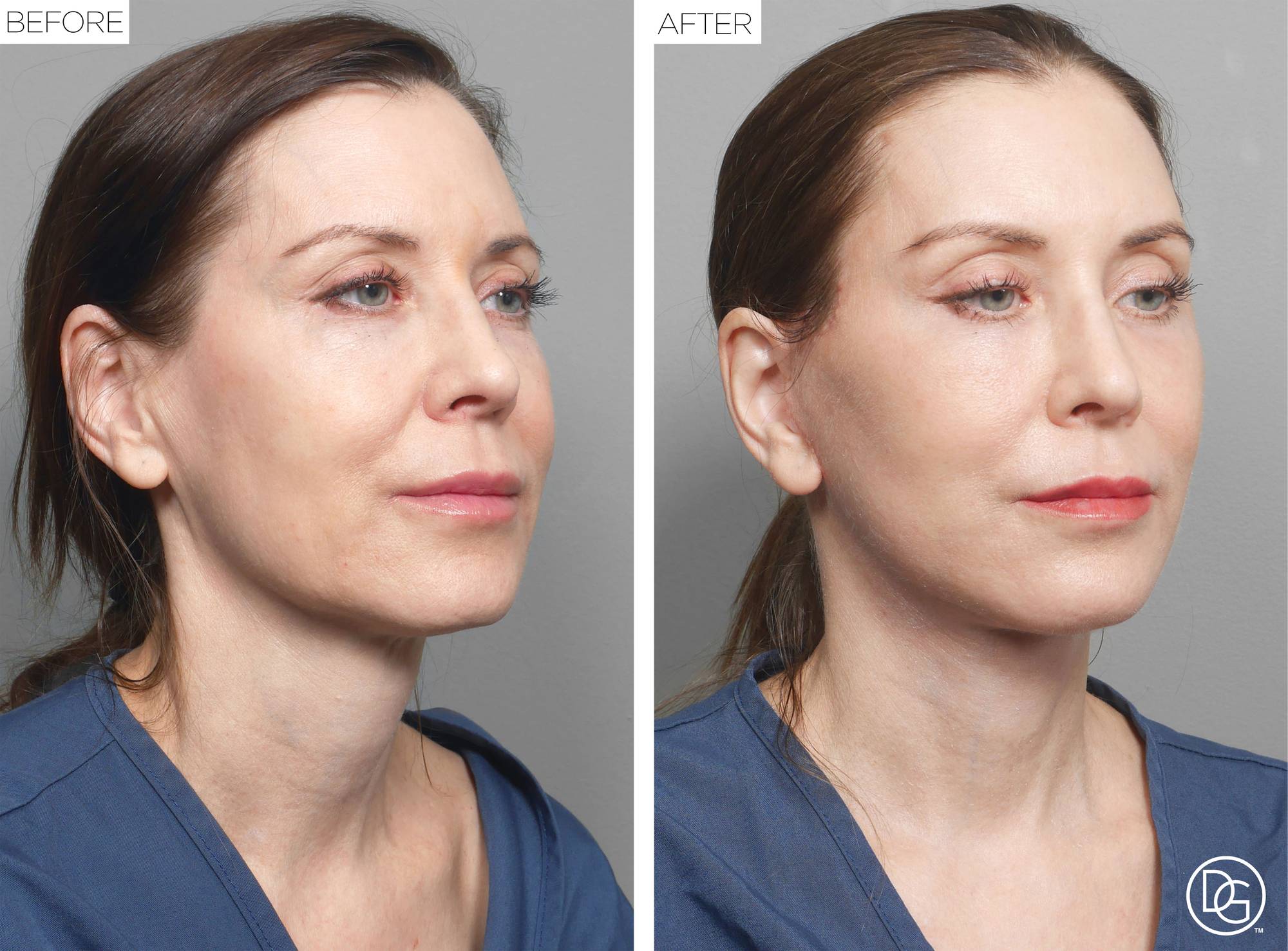 Before & After Image