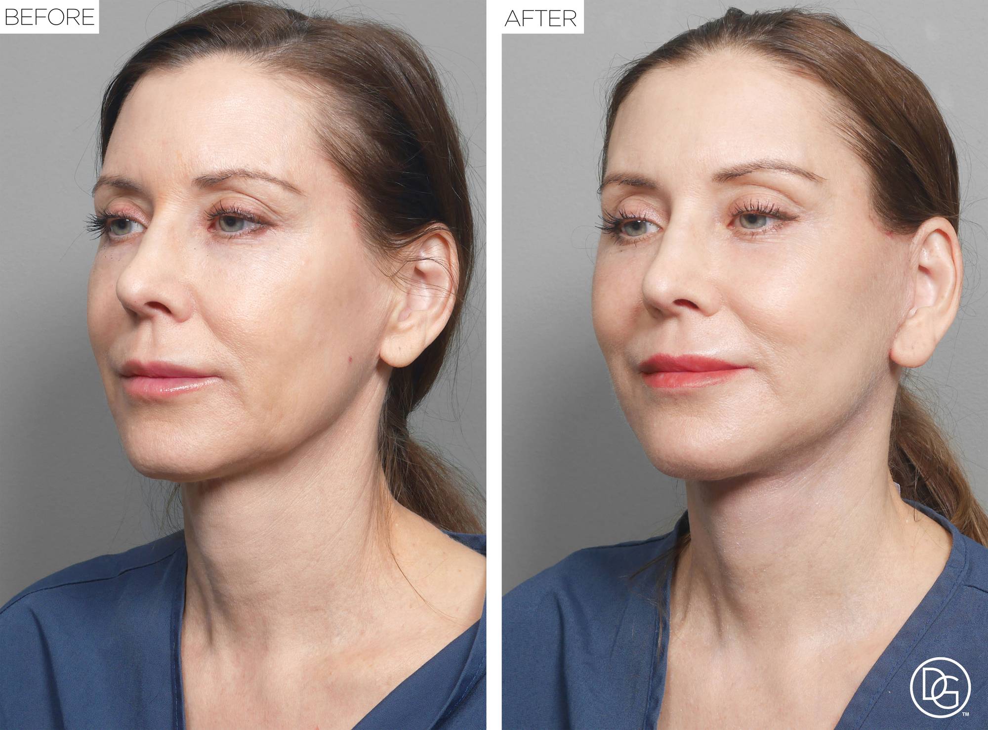 Before & After Image