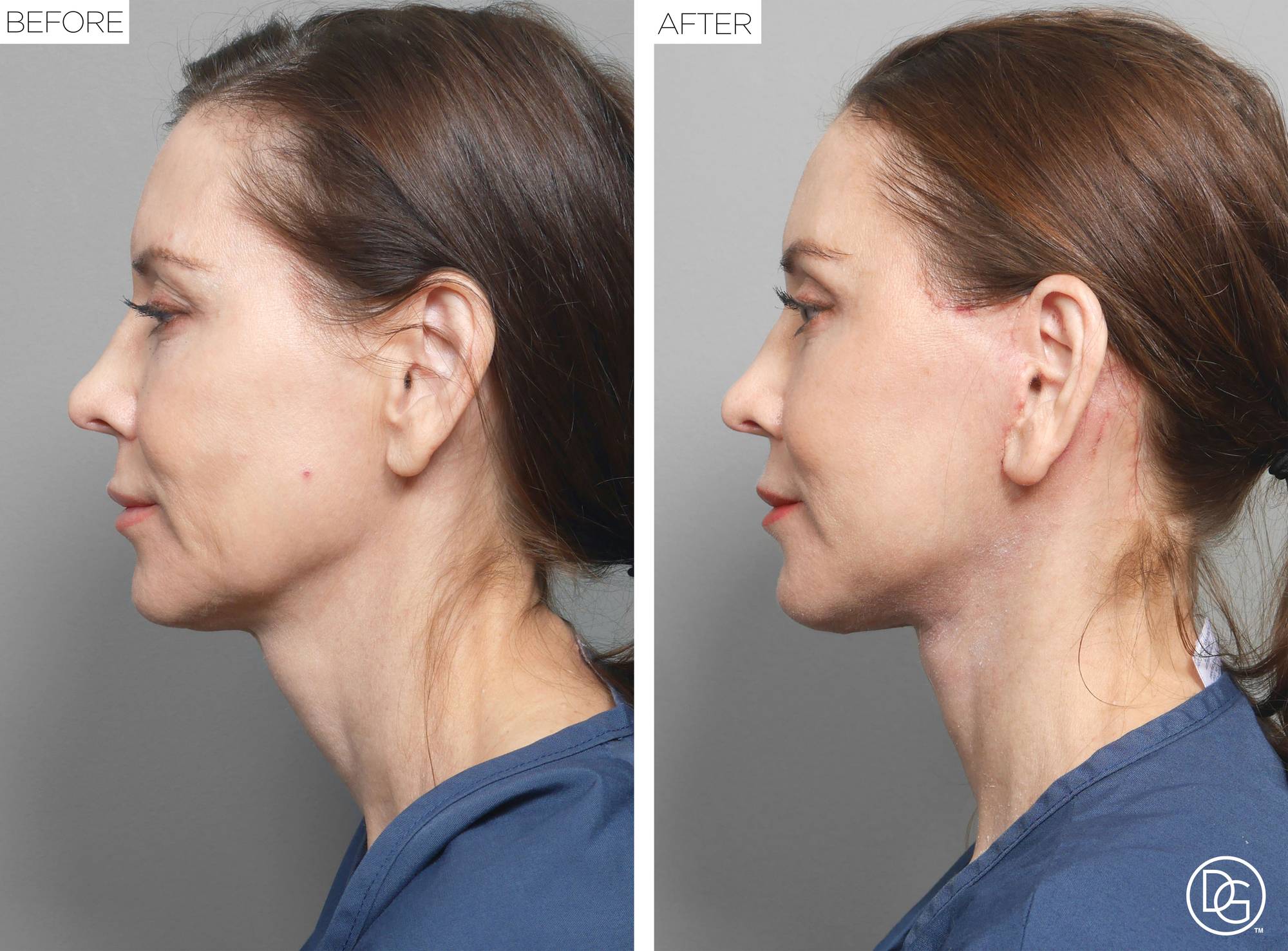 Before & After Image
