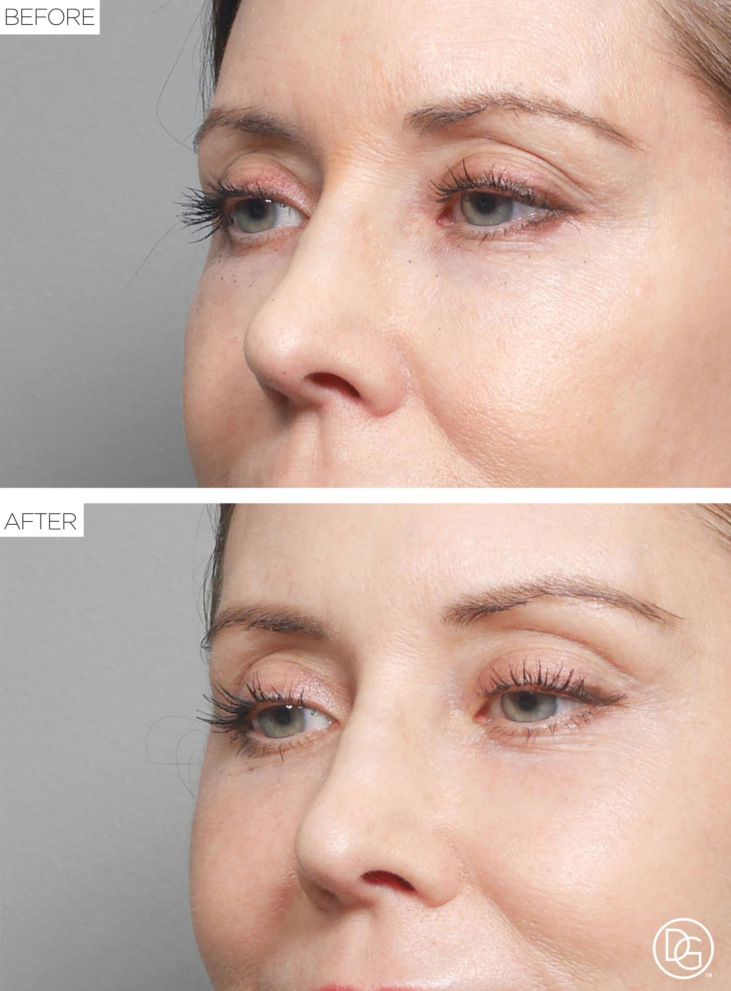 Before & After Image