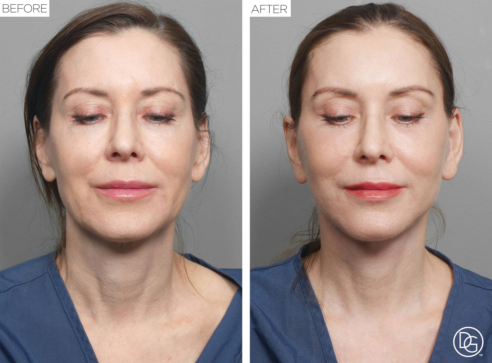 Before & After Image