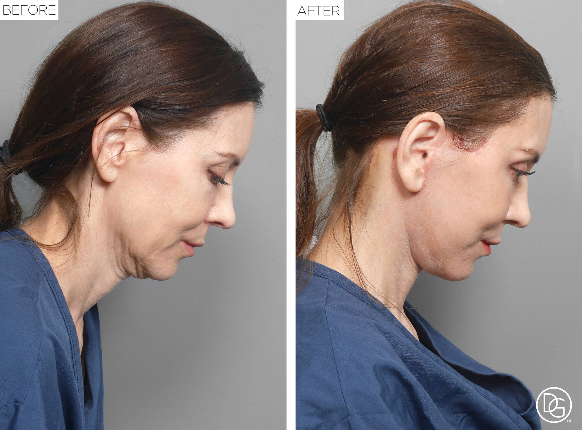 Before & After Image
